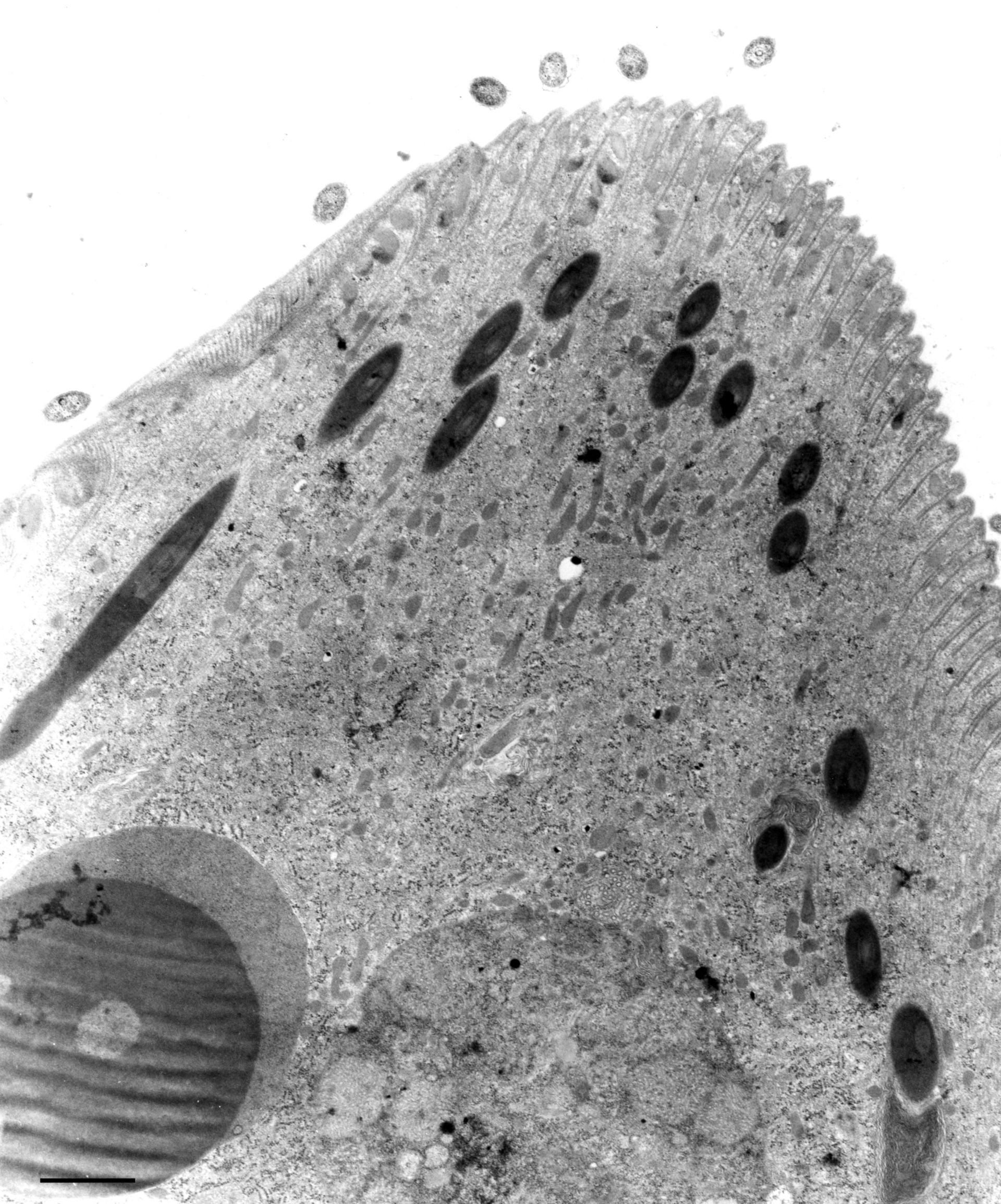 Didinium nasutum (Toxic extrusomes) - CIL:12300