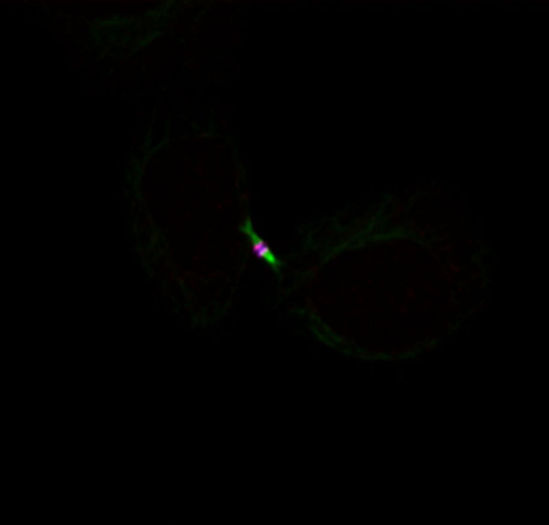 Homo sapiens (Midbody) - CIL:7243