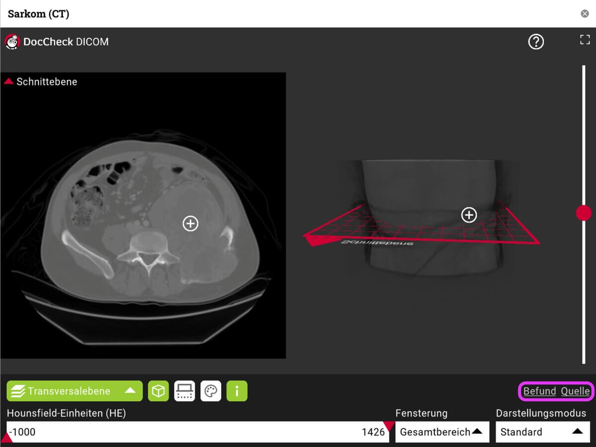 DICOM-Viewer 6