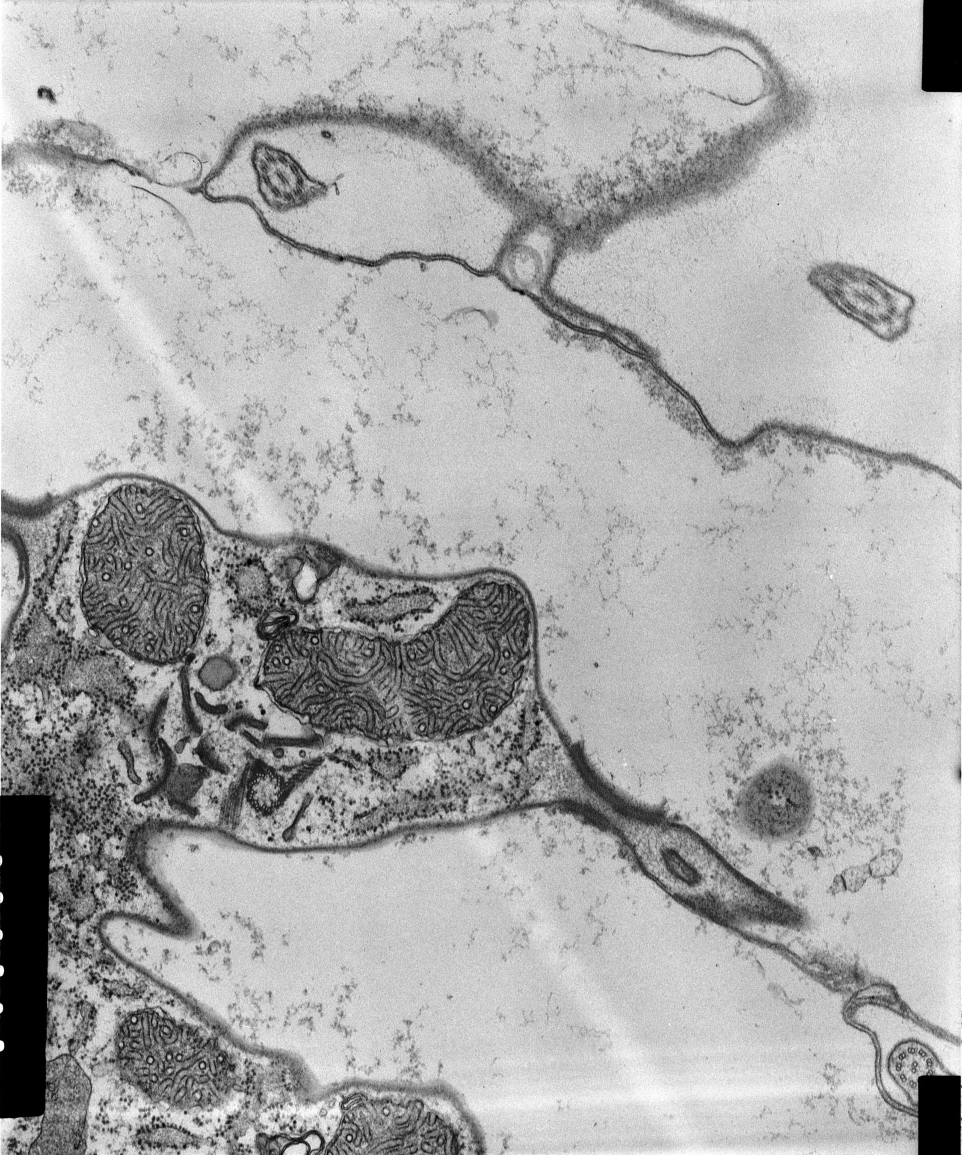 Coleps hirtus (Tubular mitochondria) - CIL:9016
