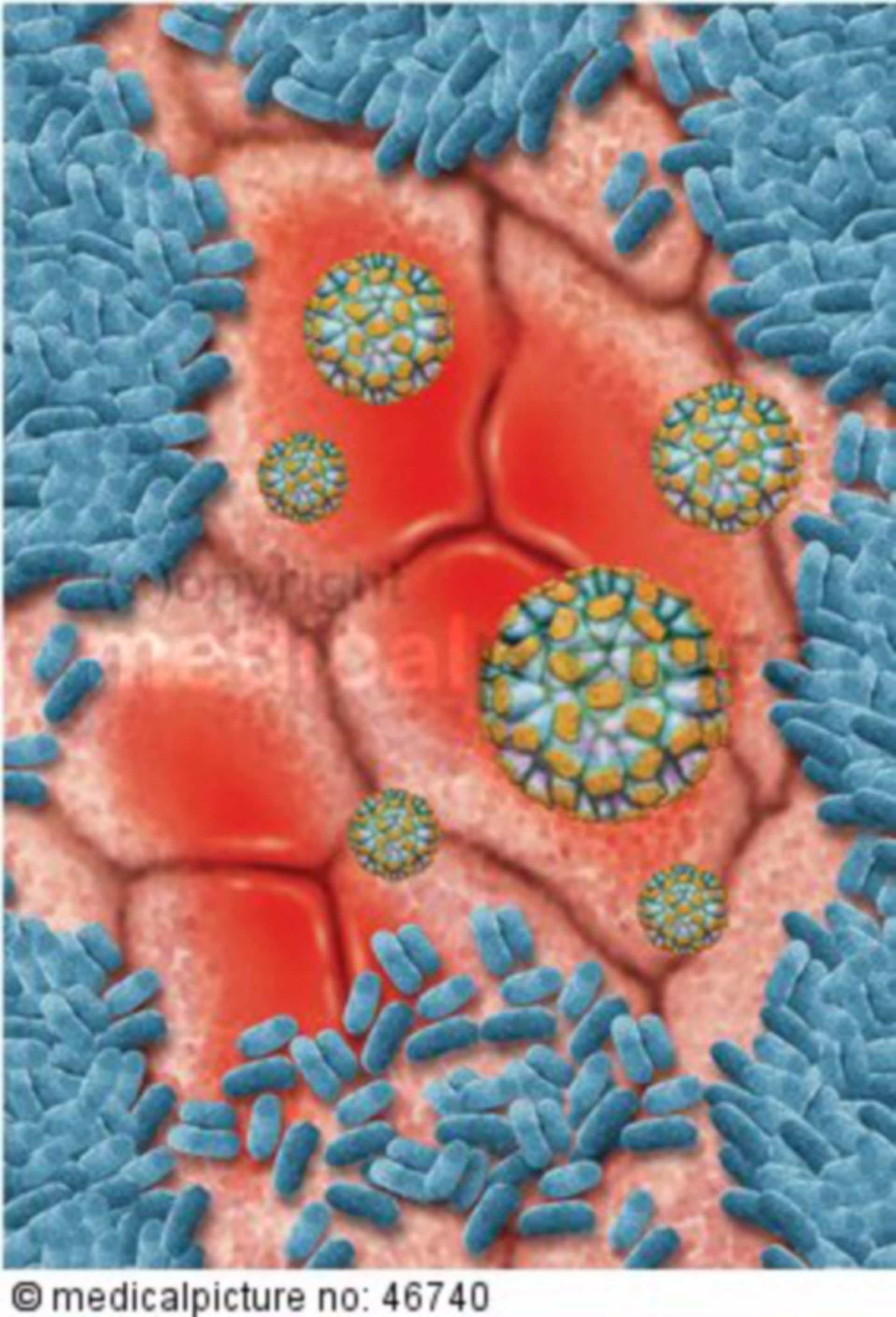  Norwalk Virus, Norovirus im Darm 
