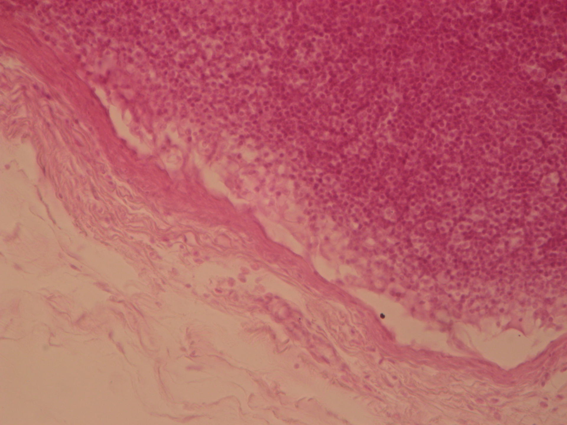 Lymphknoten des Rindes 9 - Marginalsinus