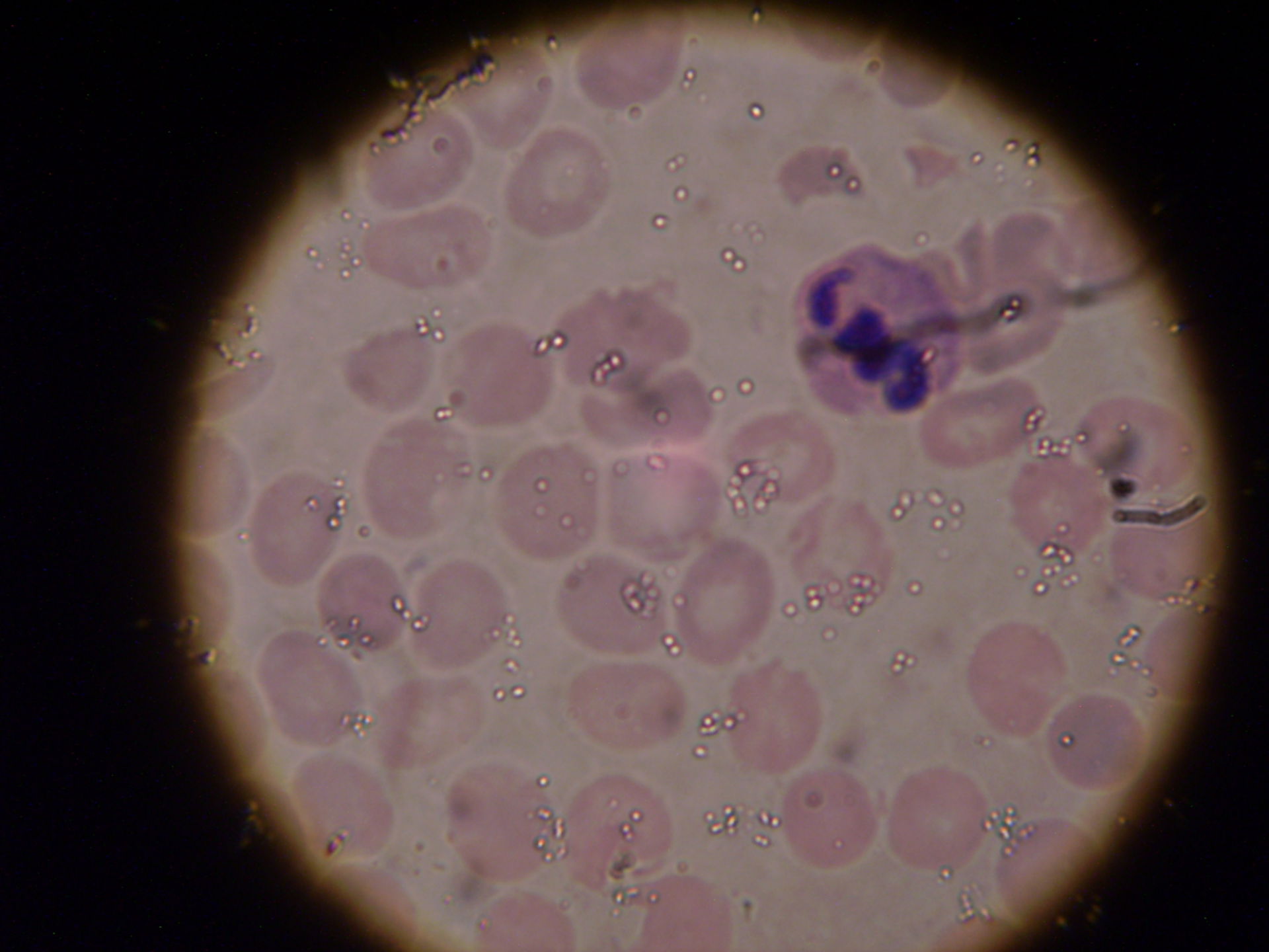 plasmodium bandforme.