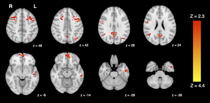 low-res_fmri_shows_decreased_functional_connectivity_after_expos_original.jpg