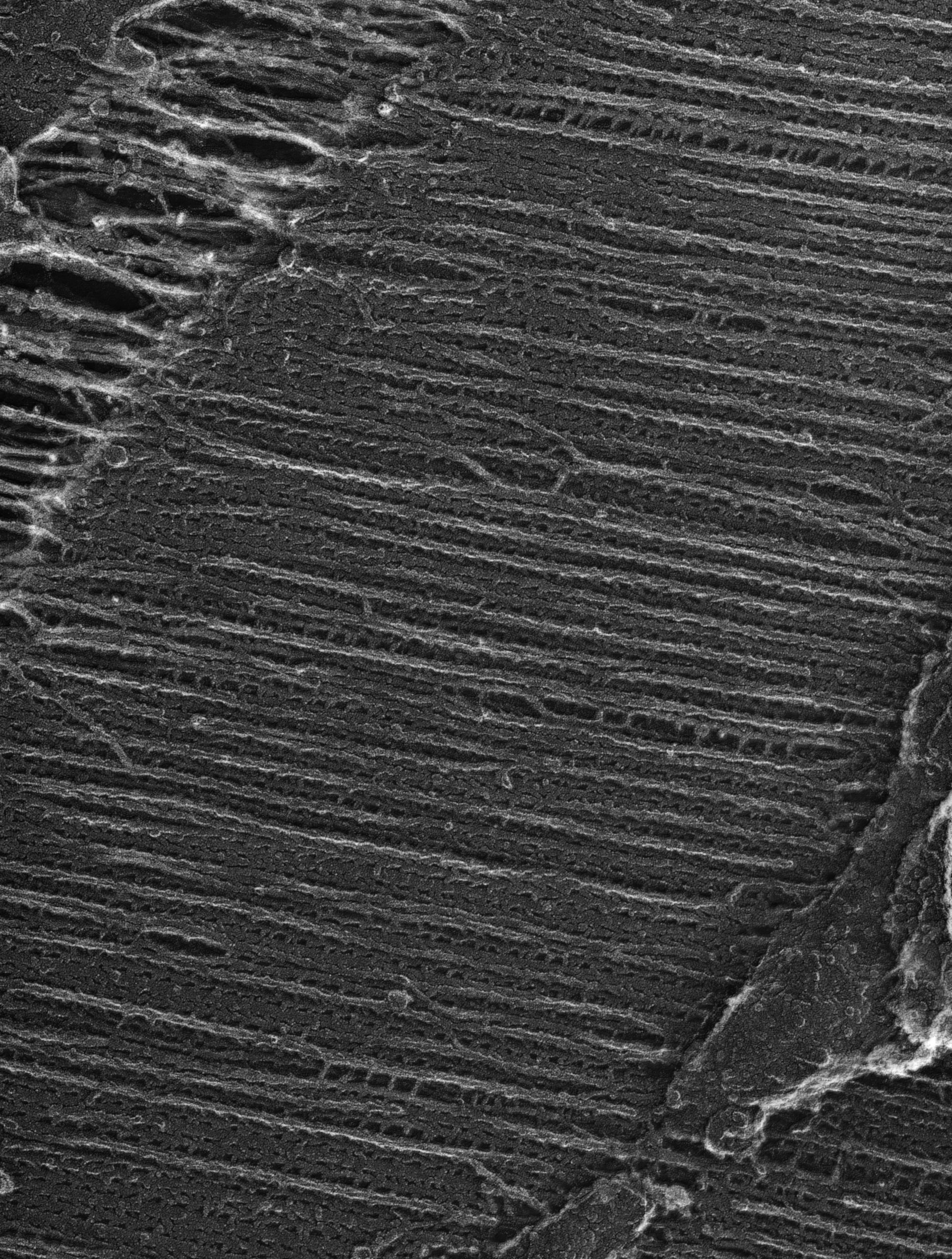 Damselfly (Sarcoplasmic reticulum) - CIL:36088