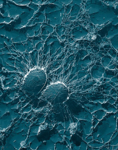 Multi resistente Staphylococcus aureus Bakterien sind die wohl prominentesten Vertreter unter den antibiotikaresistenten Bakterien. Credit: By Eric Erbe, Christopher Pooley [Public domain], via Wikimedia Commons.