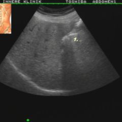 Postprandial DocCheck Flexikon