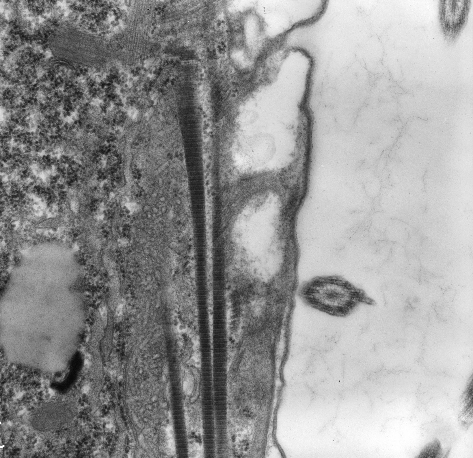 Conchophthirus curtus (Cortical membranes) - CIL:25900
