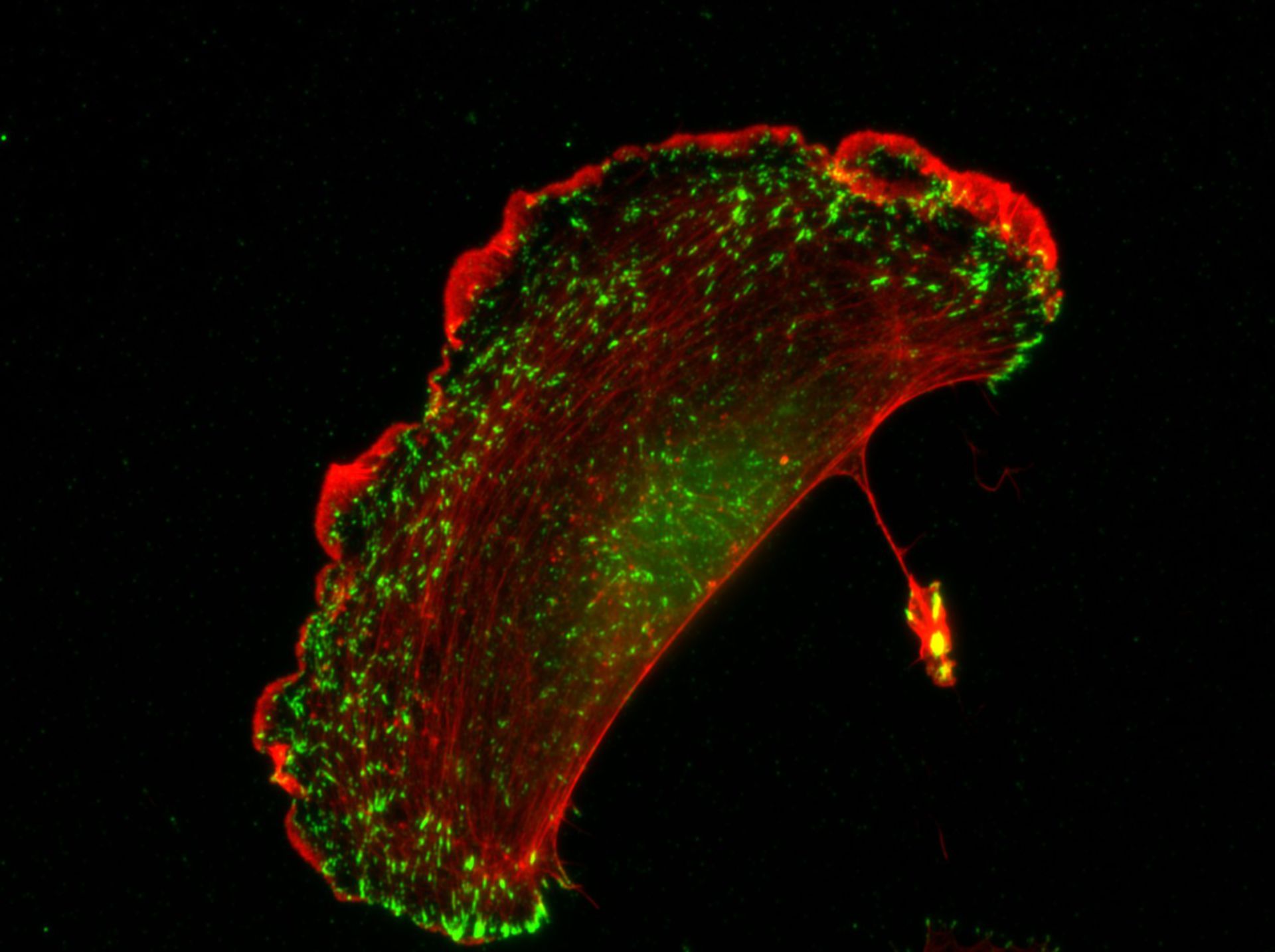 Homo sapiens (Actin cytoskeleton) - CIL:7440