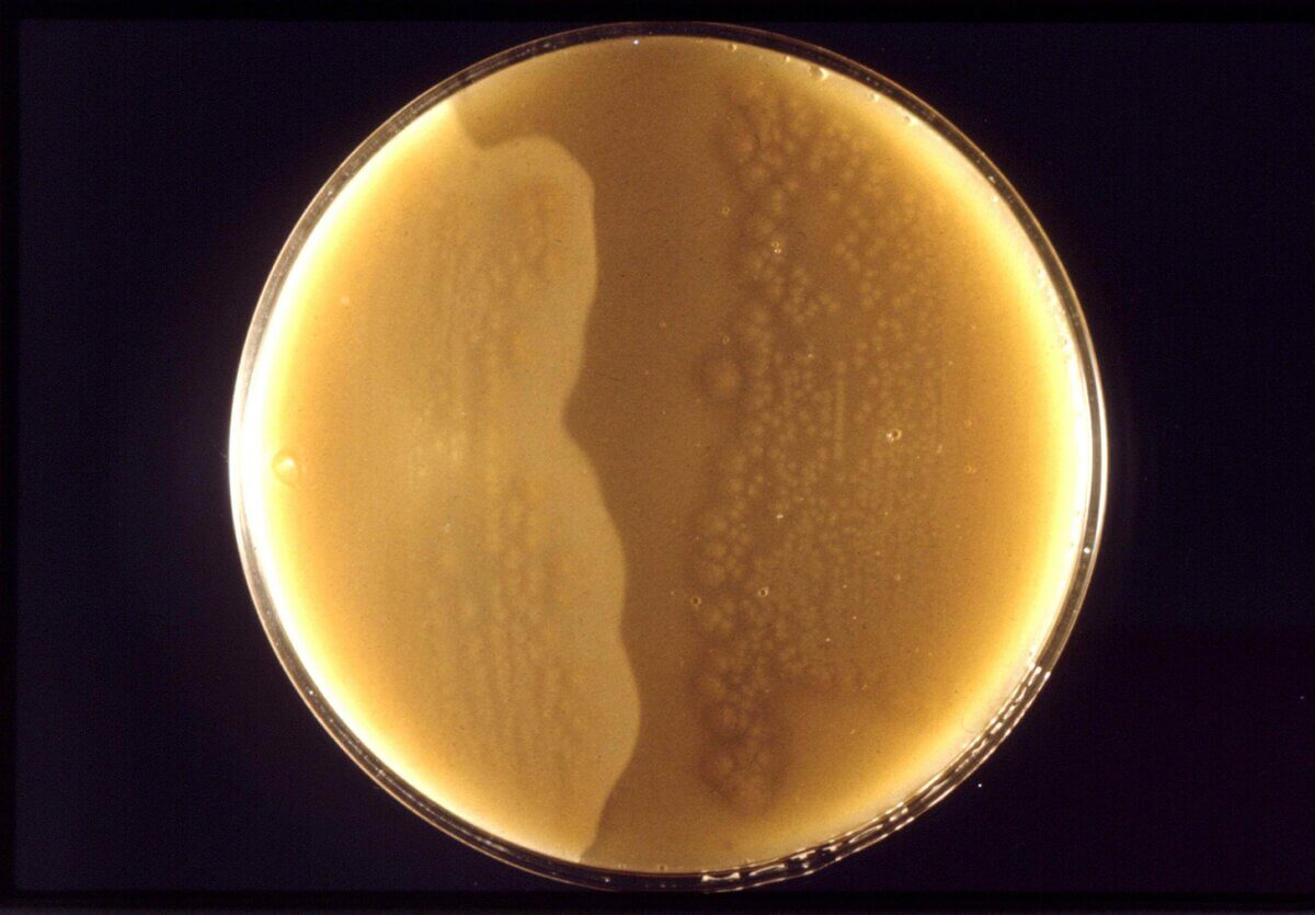 Clostridium perfringens
