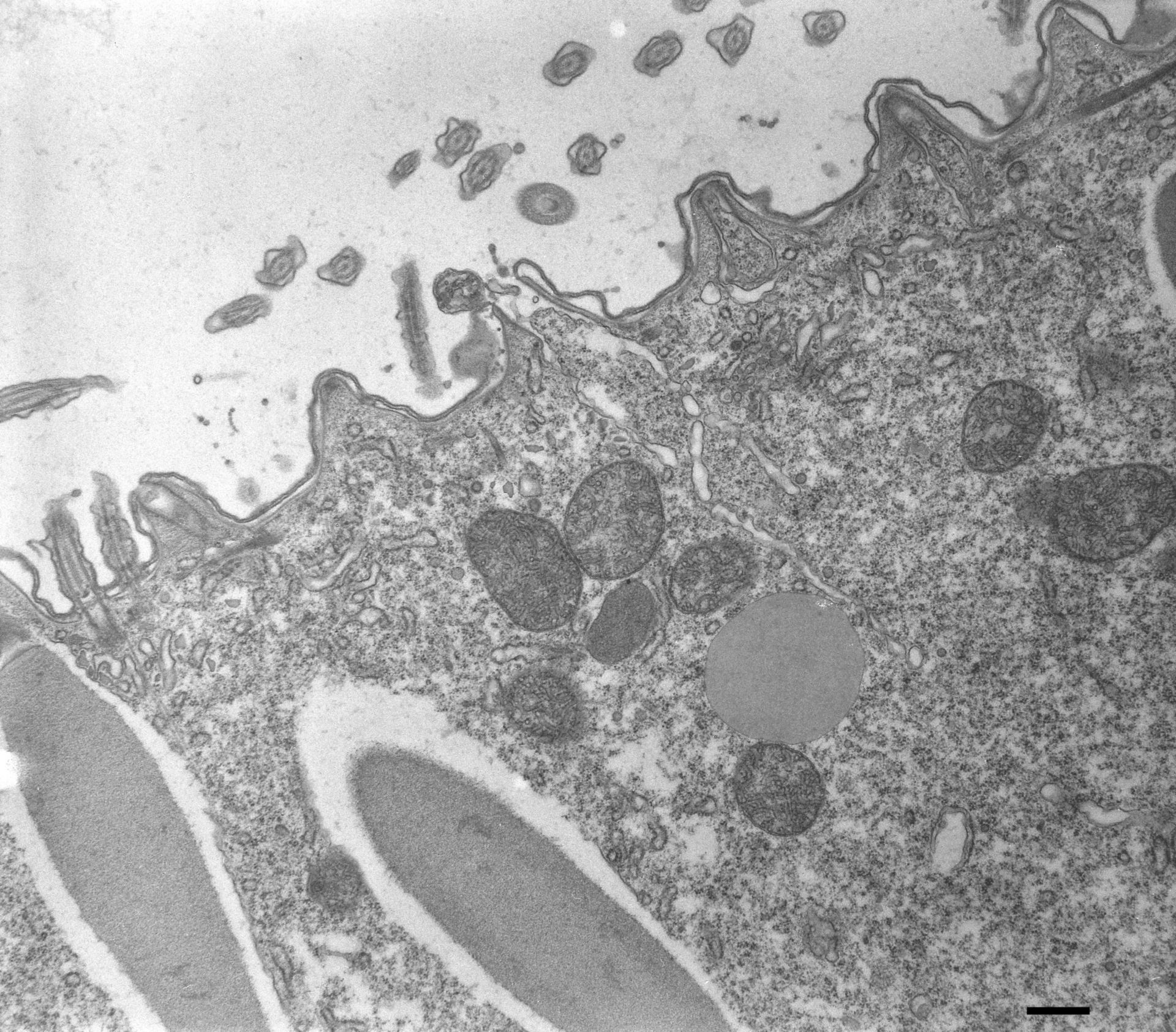 Paramecium multimicronucleatum (Cell cortex) - CIL:36682