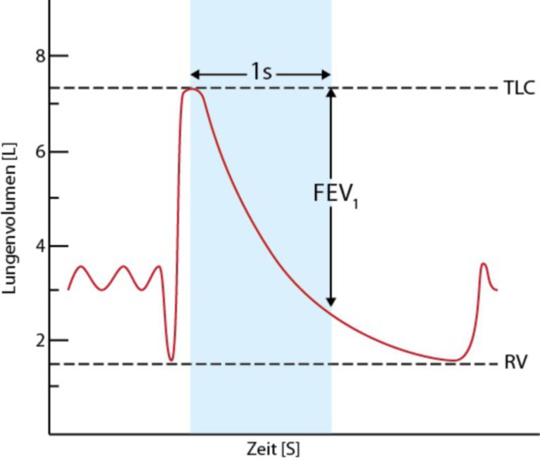 Lungs tiffeneau test fev1 doccheck