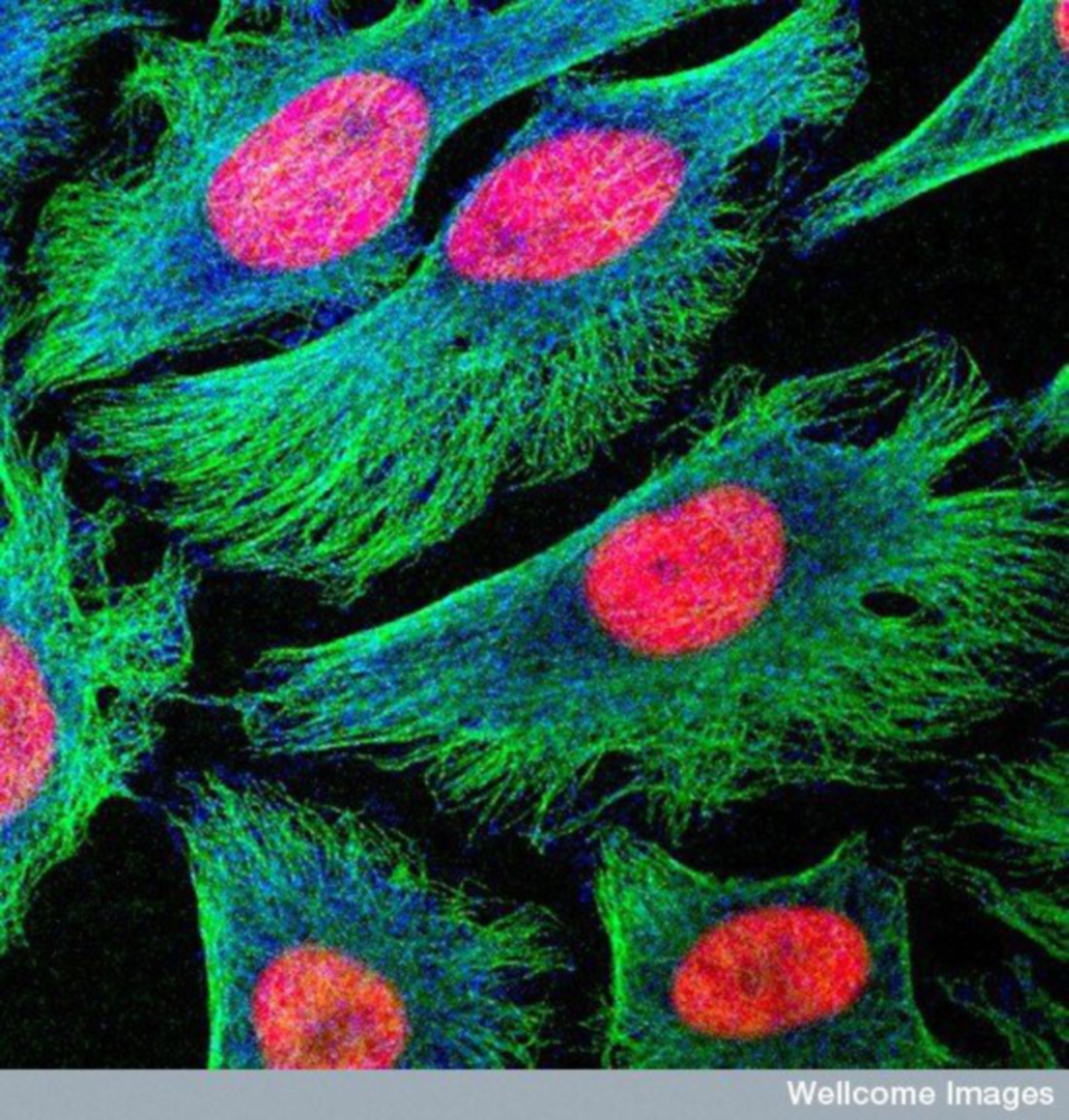 Cancer - HeLa - Image of the Week – August 18, 2014