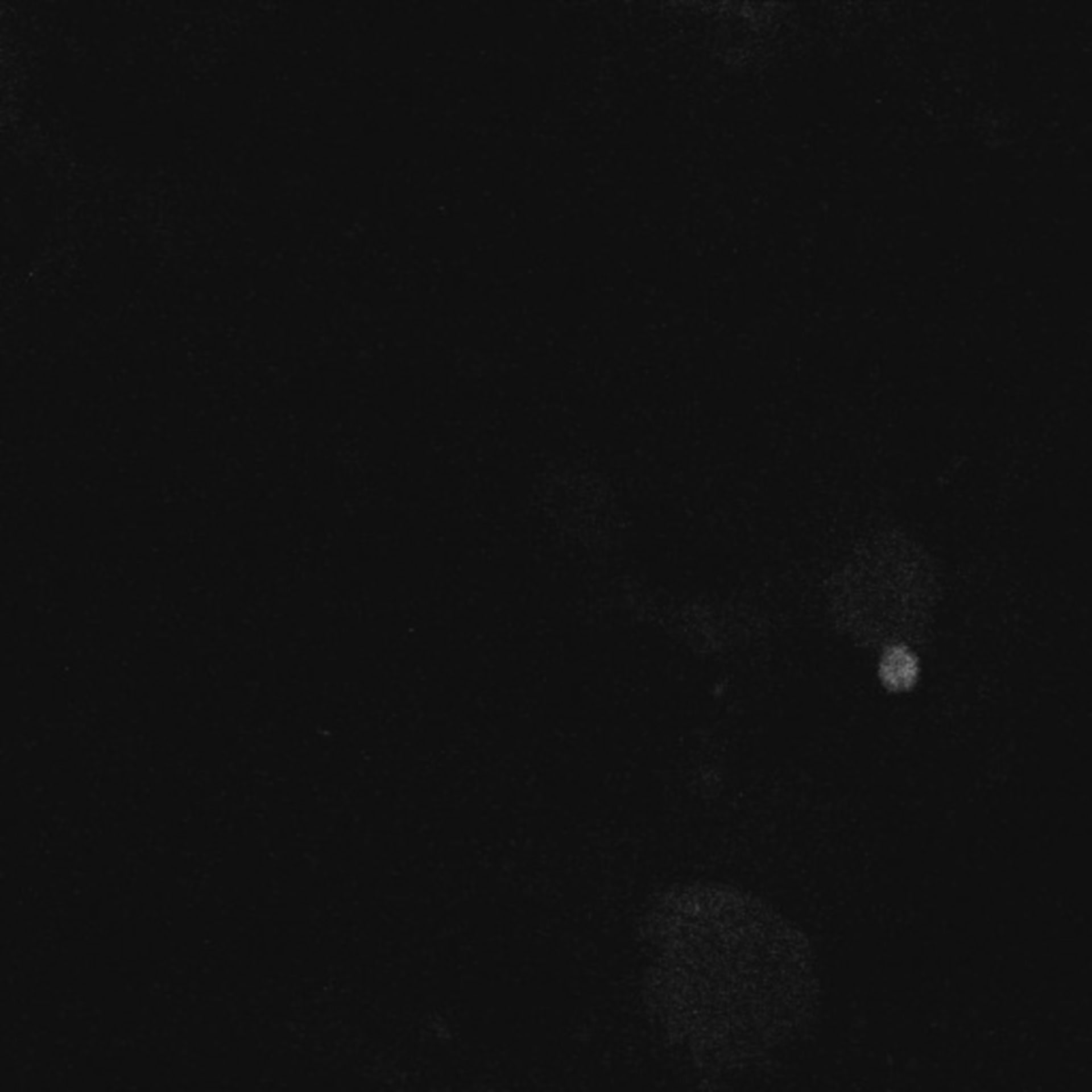 Xenopus laevis (Neuronal cell body) - CIL:36865