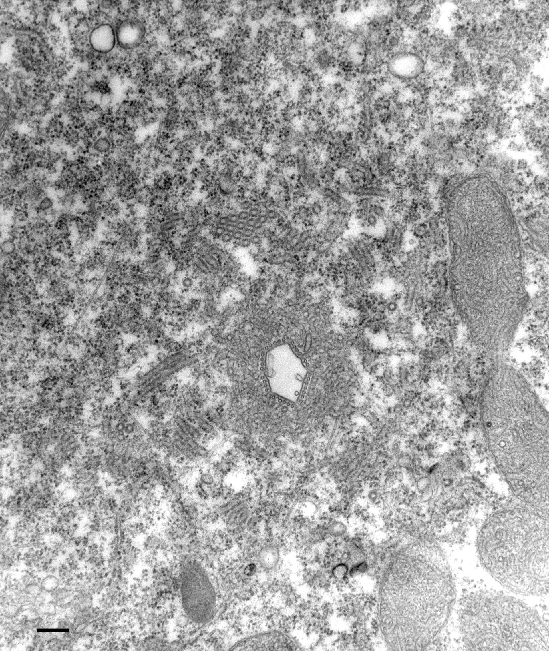 Paramecium multimicronucleatum (Microtubule associated complex) - CIL:13111