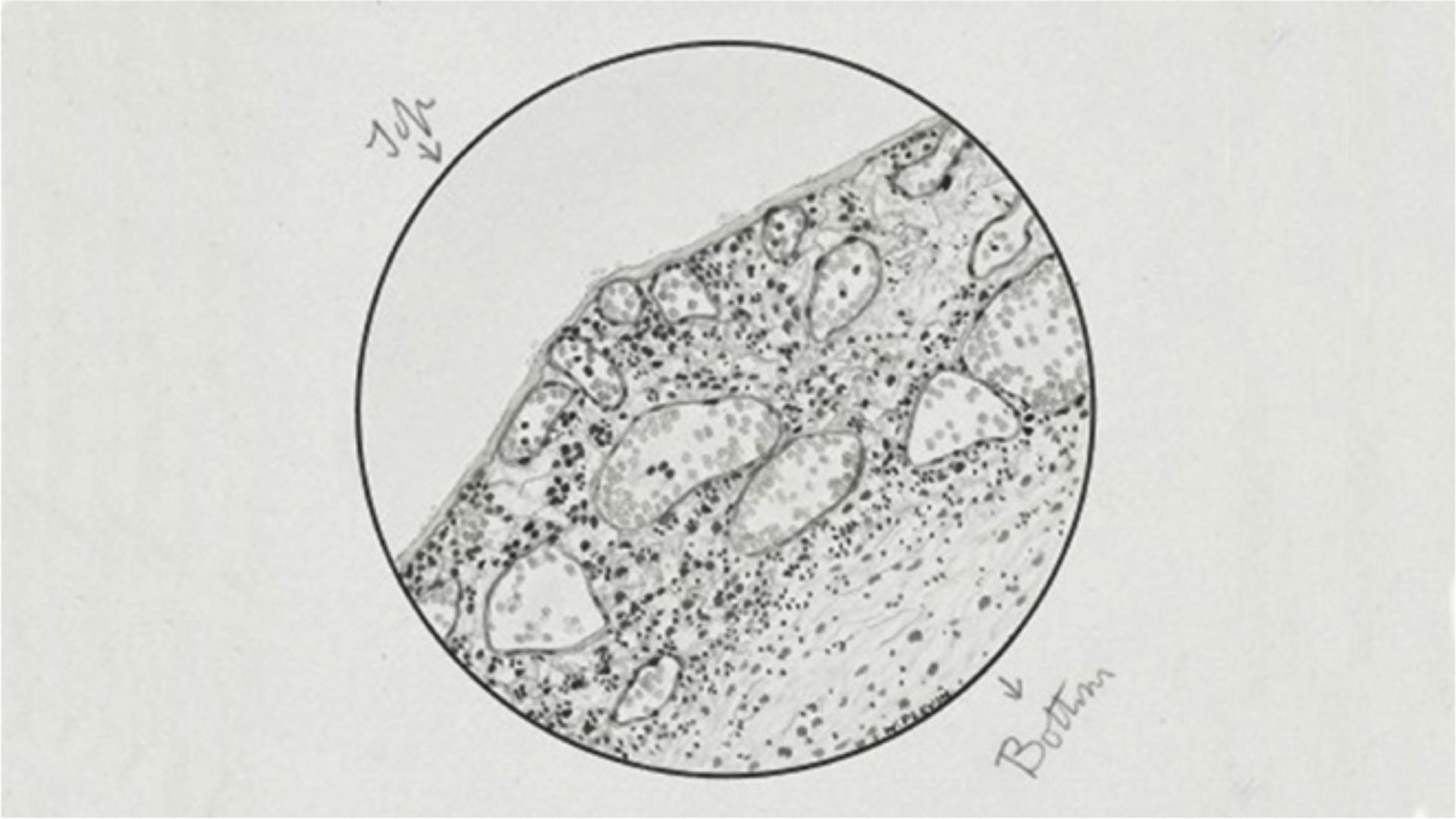 Original-Zeichnung von 1918: Der spanische Grippe-Virus