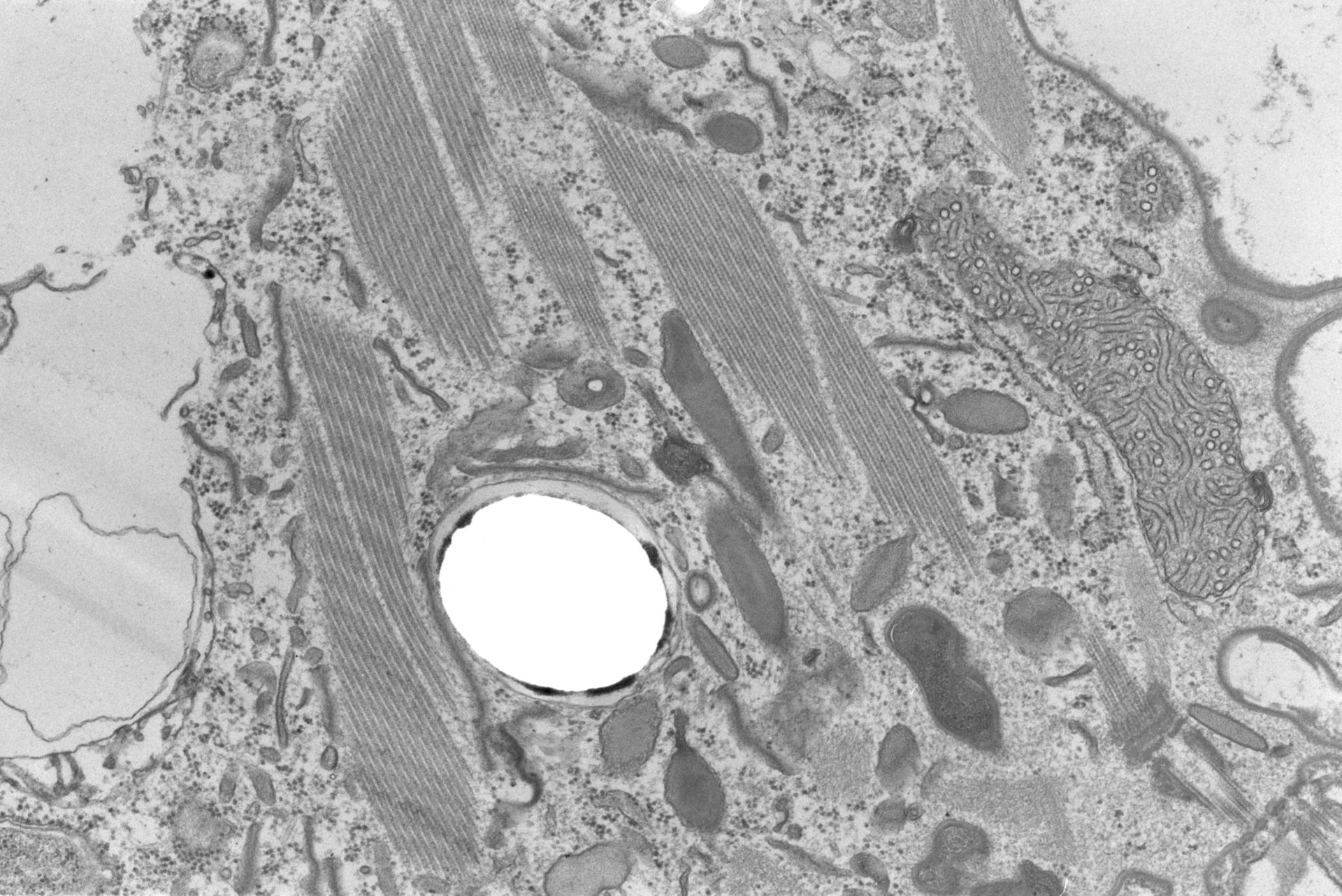 Coleps hirtus (Bacteroid-containing symbiosome) - CIL:2865
