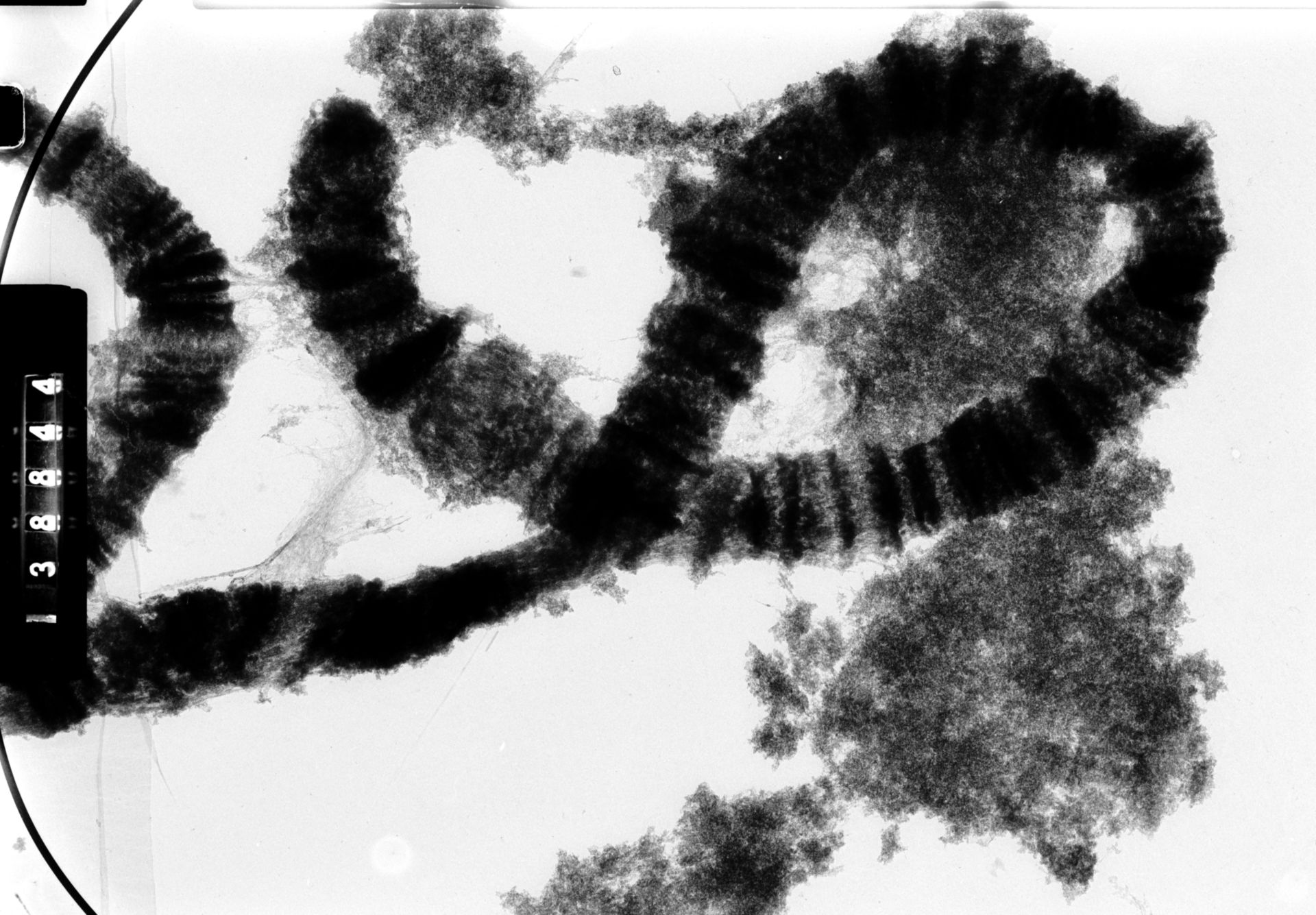 Drosophila melanocephala (Polytene chromosome) - CIL:35435