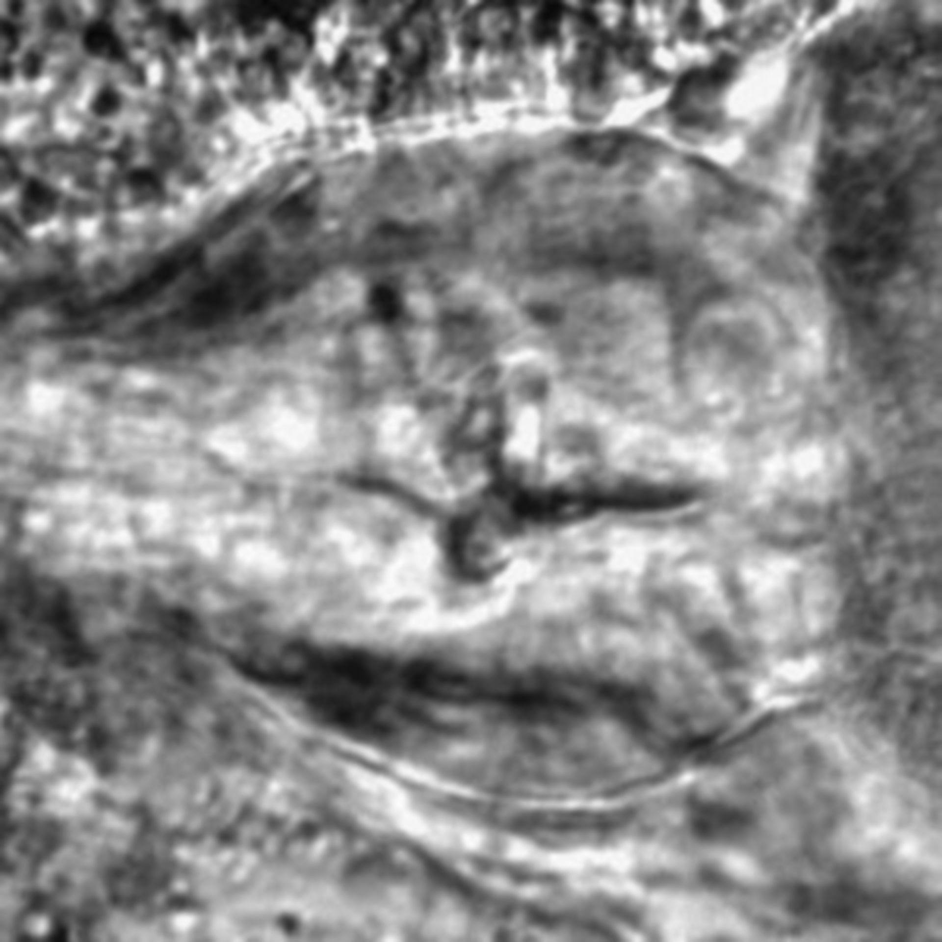 Caenorhabditis elegans - CIL:2291