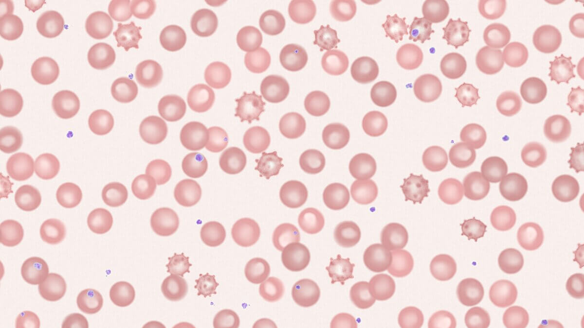 Echinozyten