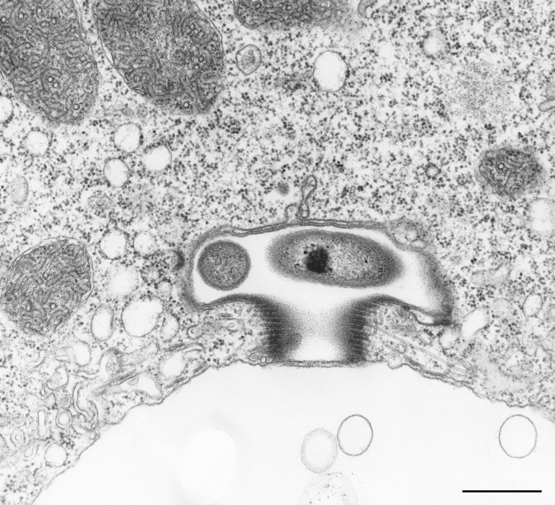 Vorticella convallaria (Symbiont-containing vacuolar space) - CIL:36277