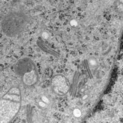 Cisterna chiasmatica DocCheck Flexikon