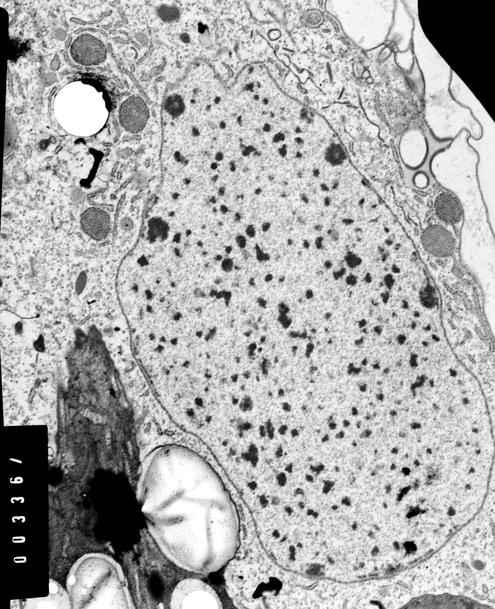 Coleps hirtus (Nucleolus) - CIL:38825