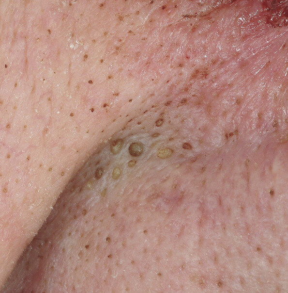 derm01_original.jpg