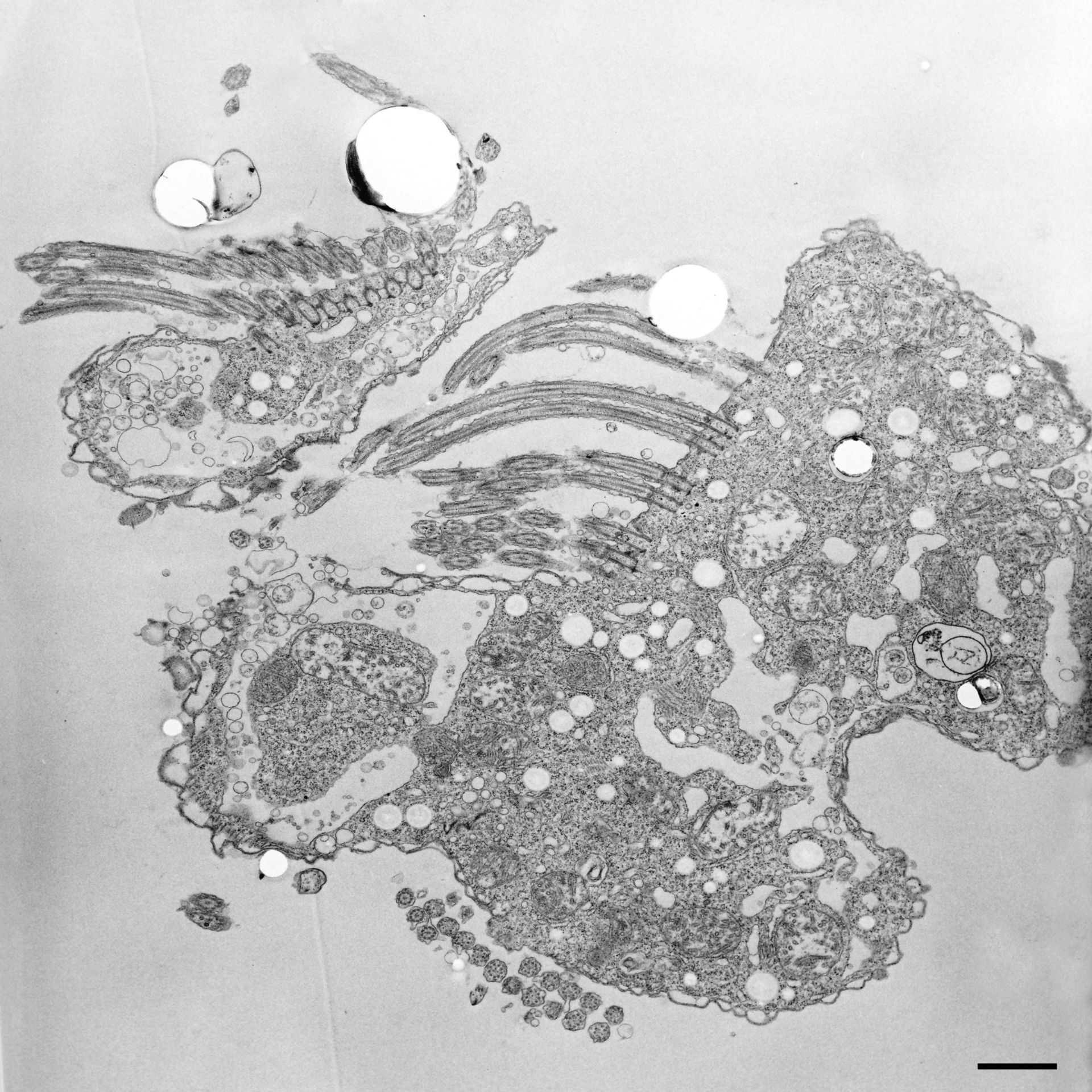 Halteria grandinella (Cytoplasm) - CIL:12325