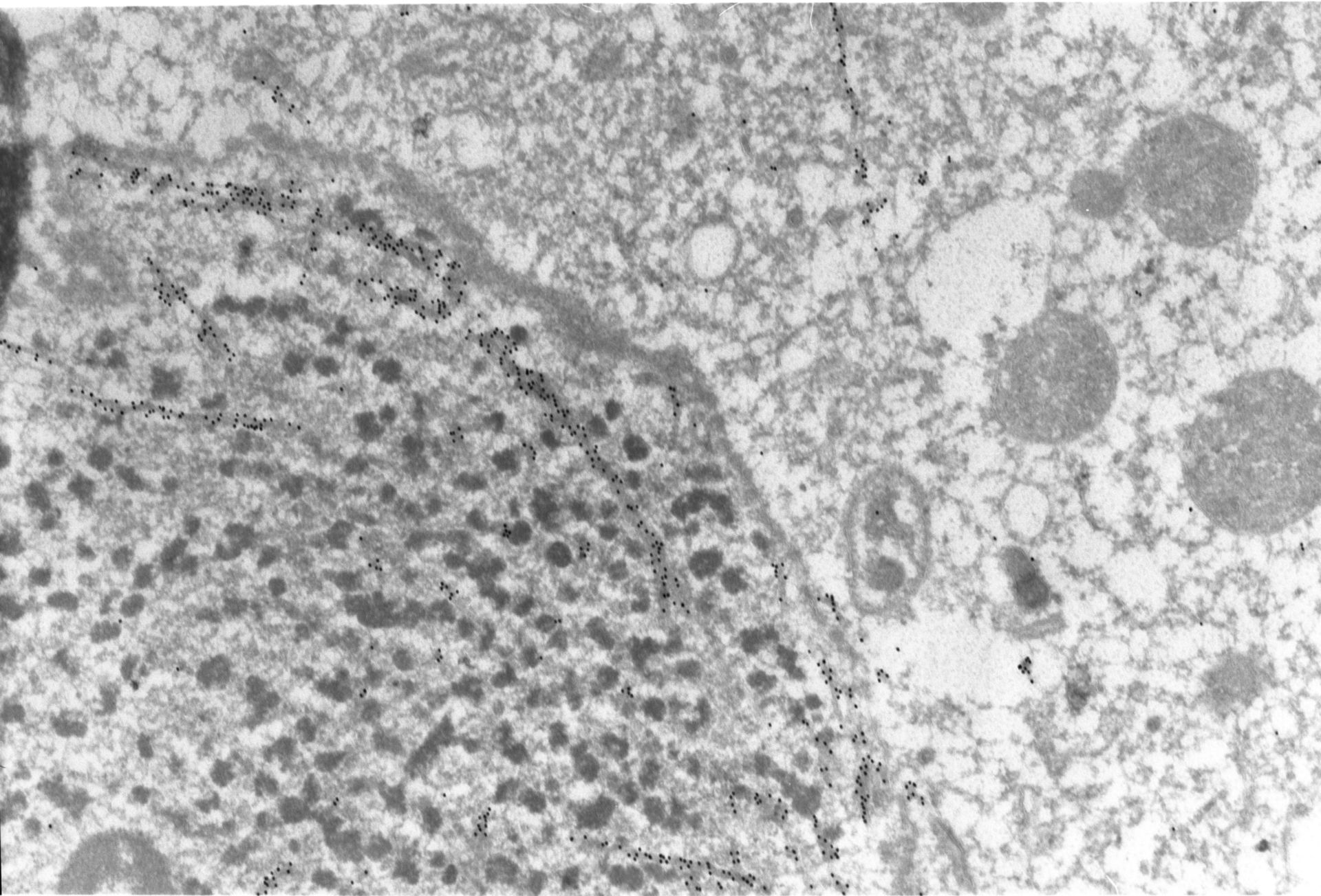 Paramecium tetraurelia (citoplasma) - CIL: 1310