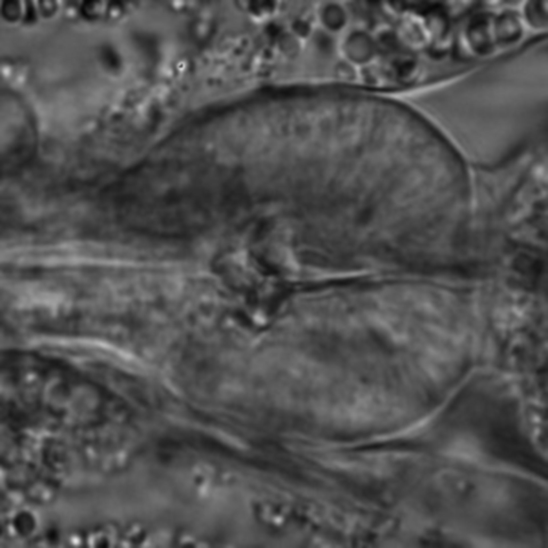 Caenorhabditis elegans - CIL:1717