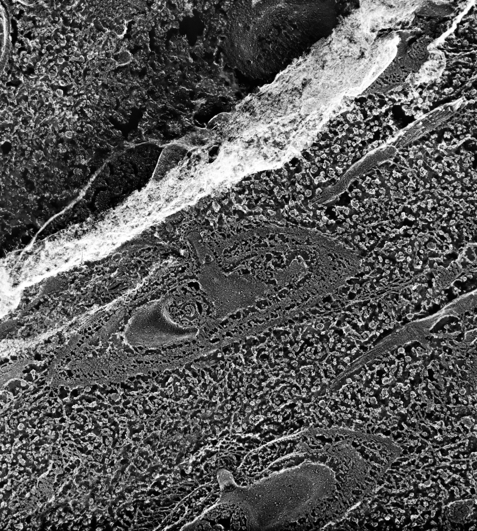 Paramecium multimicronucleatum (Early endosome lumen) - CIL:12634