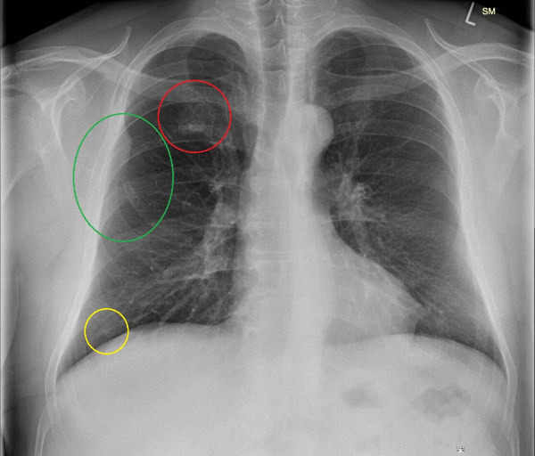 m_1434471090.jpg