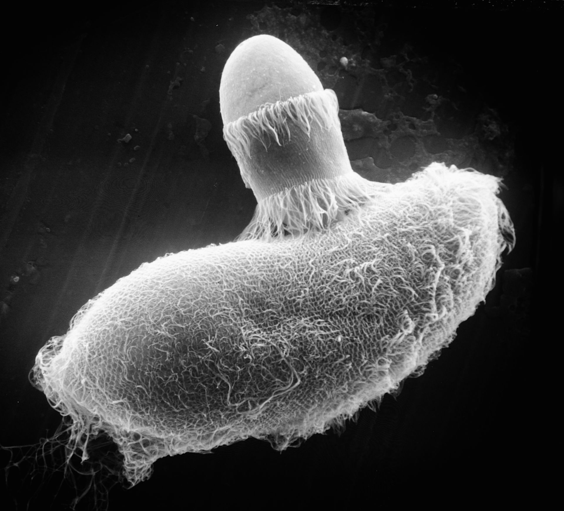 Paramecium sp. (Cell surface) - CIL:39250