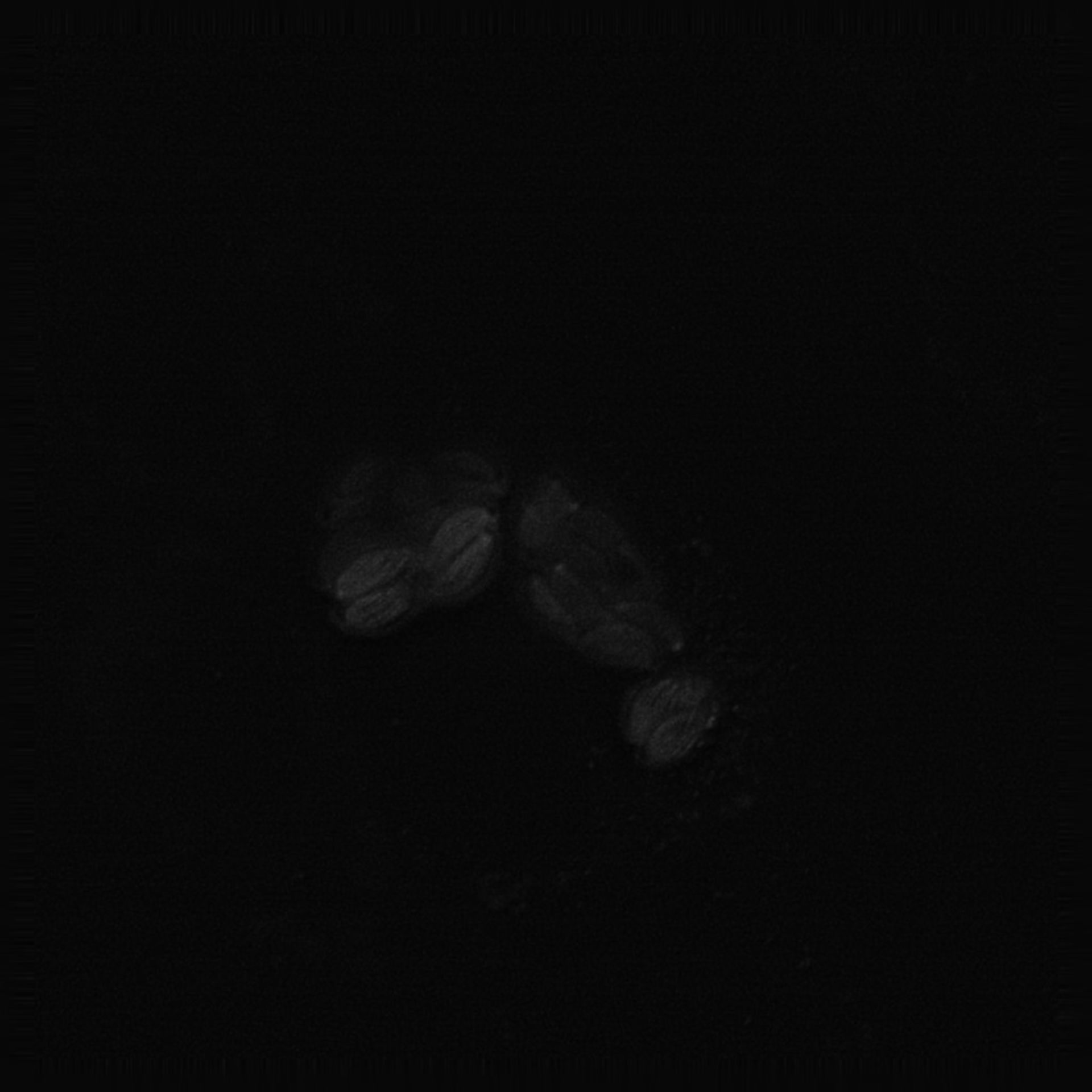 Toxoplasma gondii RH (Cortical microtubule) - CIL:10534