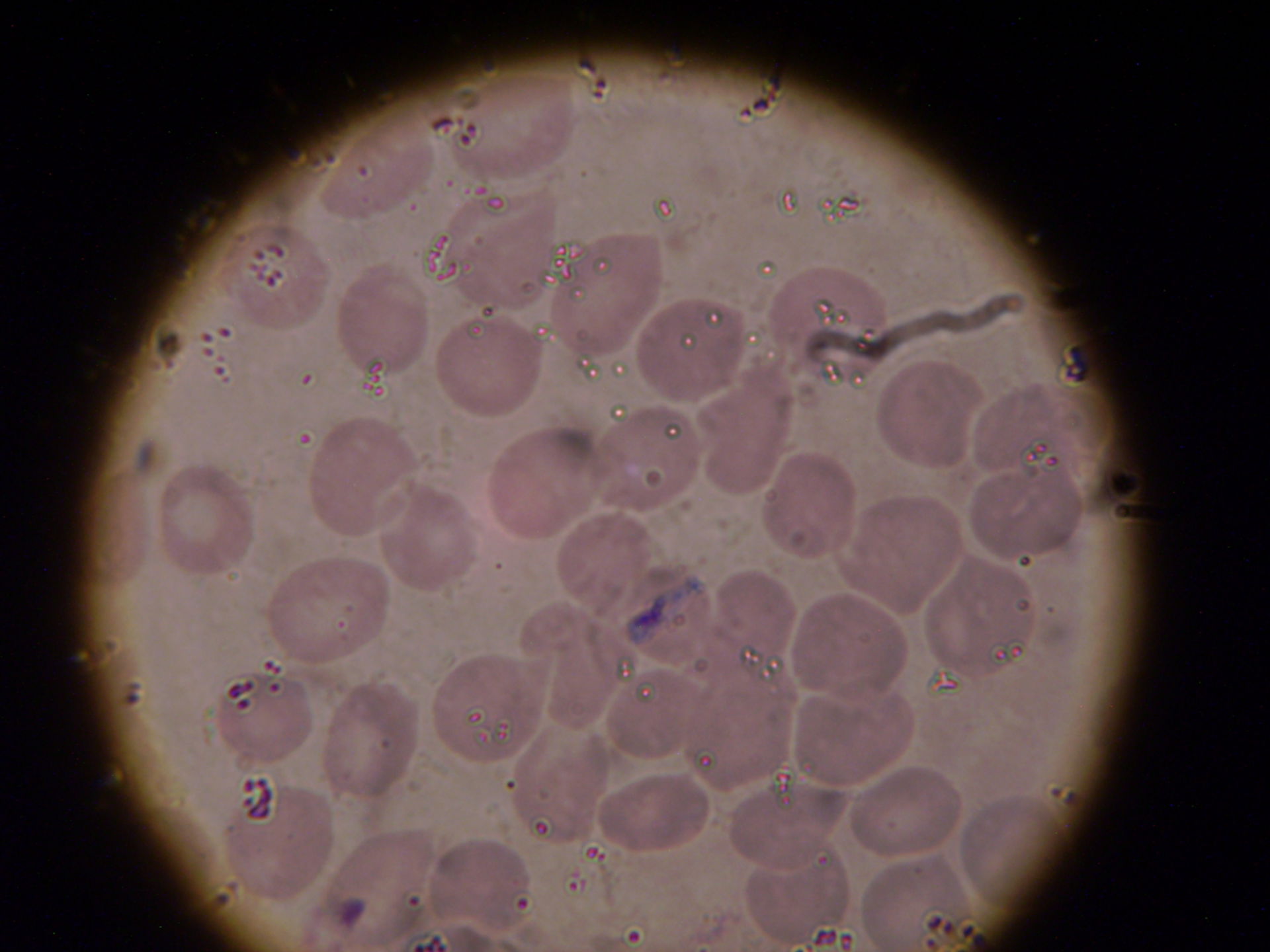 Plasmodium band-form