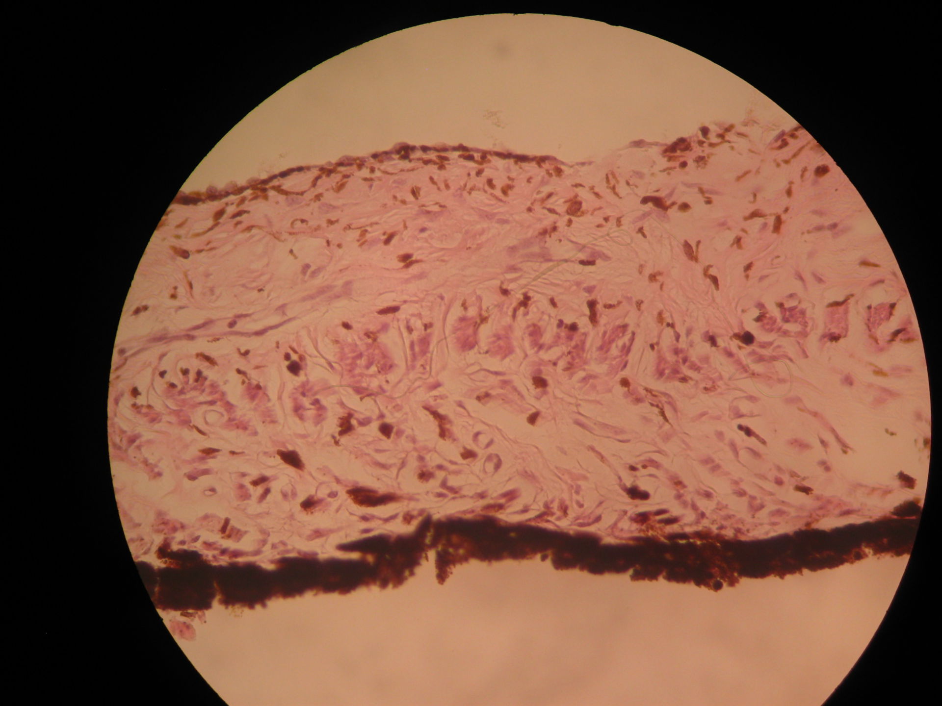 Auge des Schafes - Iris   M. dilatator pupillae