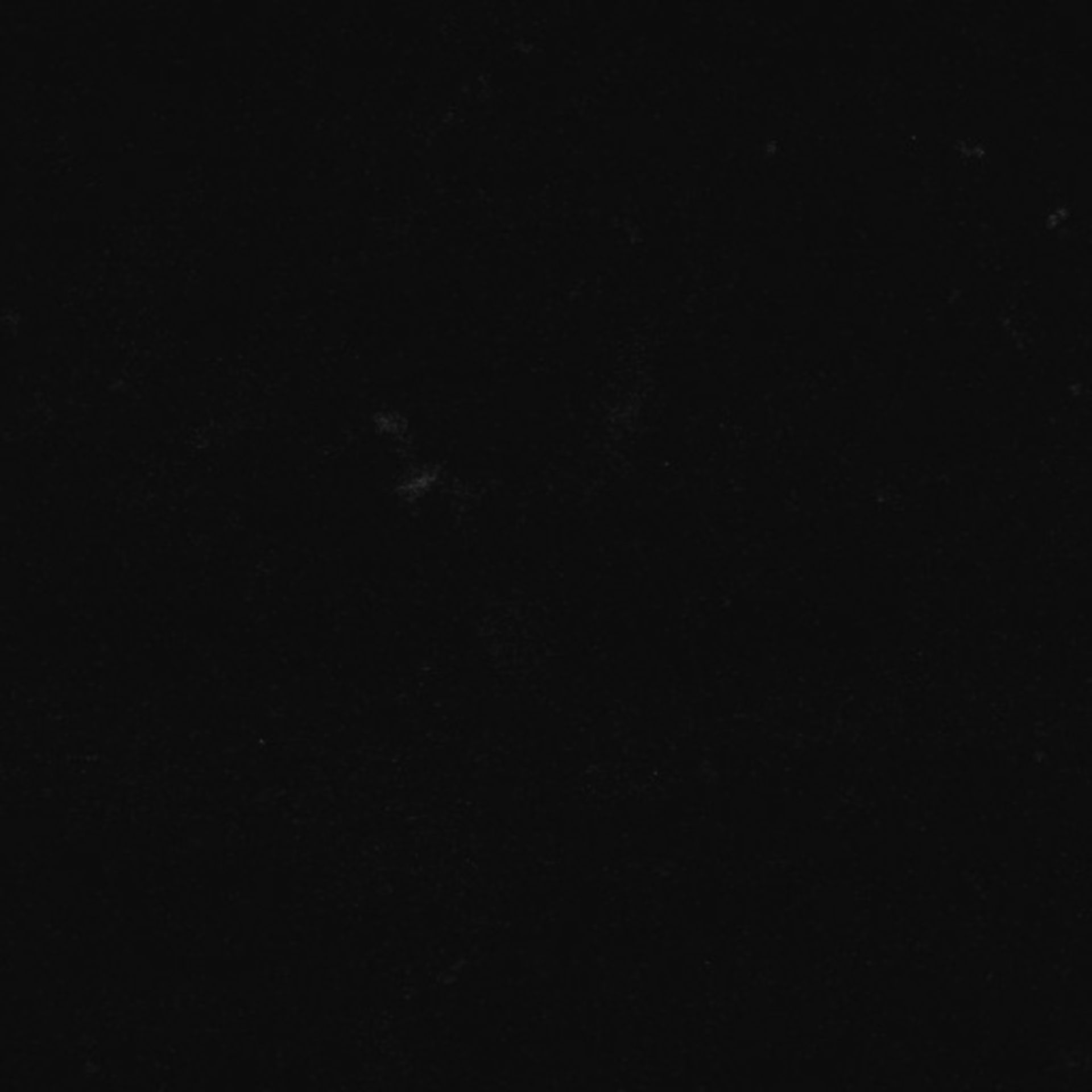 Xenopus laevis (Axon) - CIL:36912