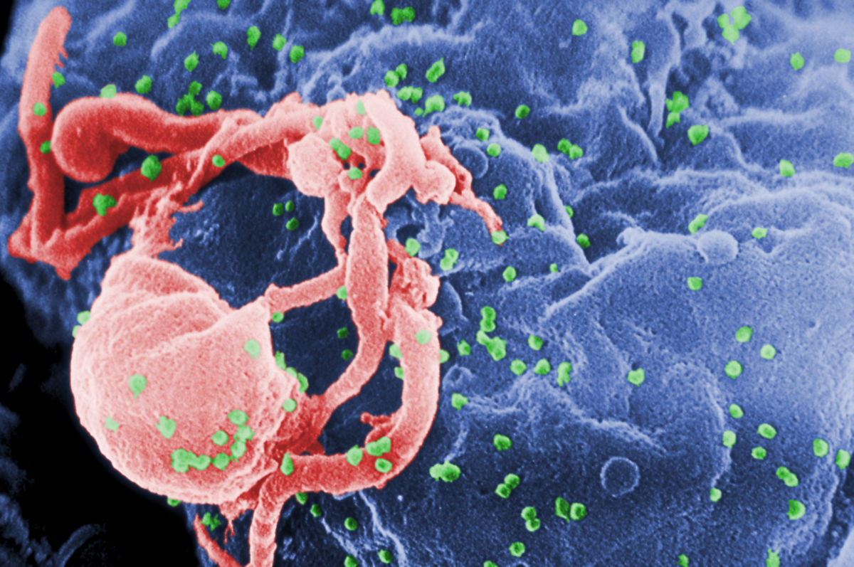 HIV-Freisetzung aus Lymphozyt (REM)