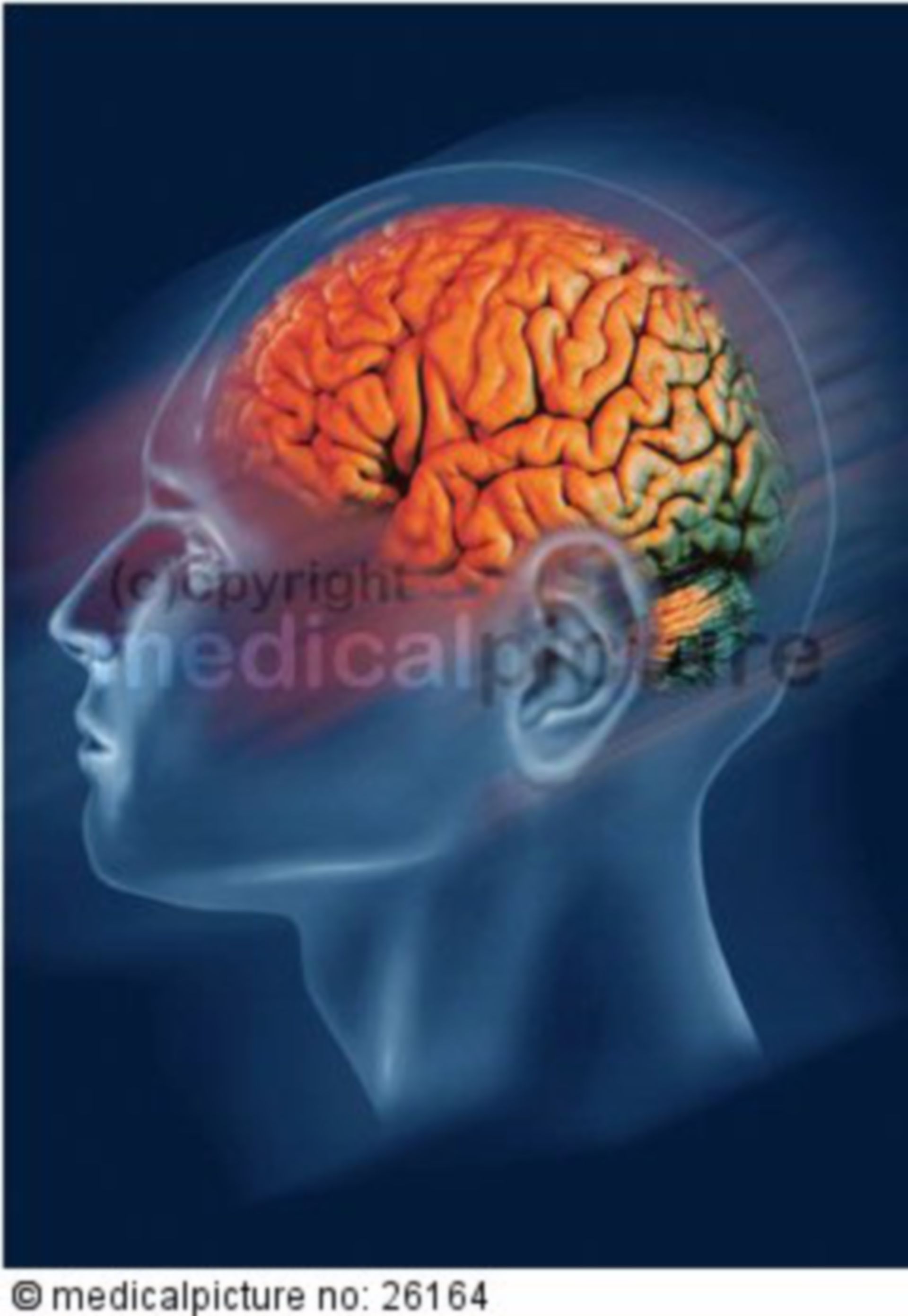  Farbiges Gehirn, colored brain 

