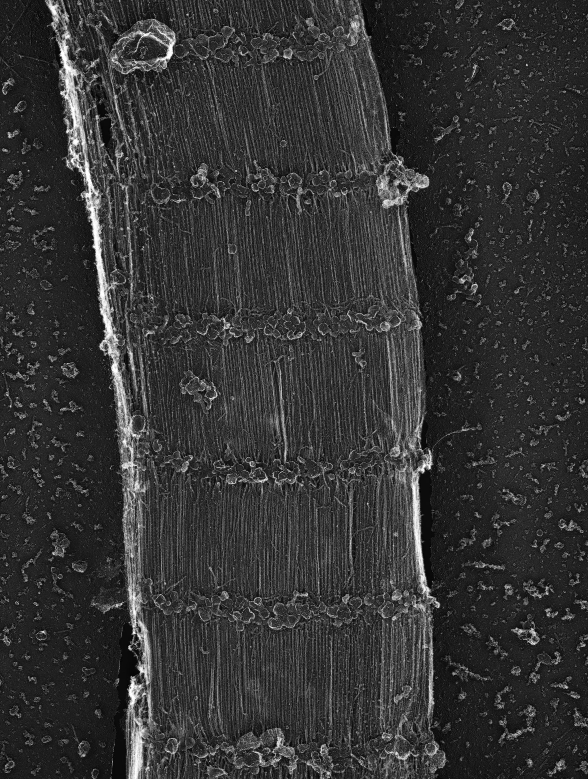 Damselfly (Sarcoplasmic reticulum) - CIL:36020