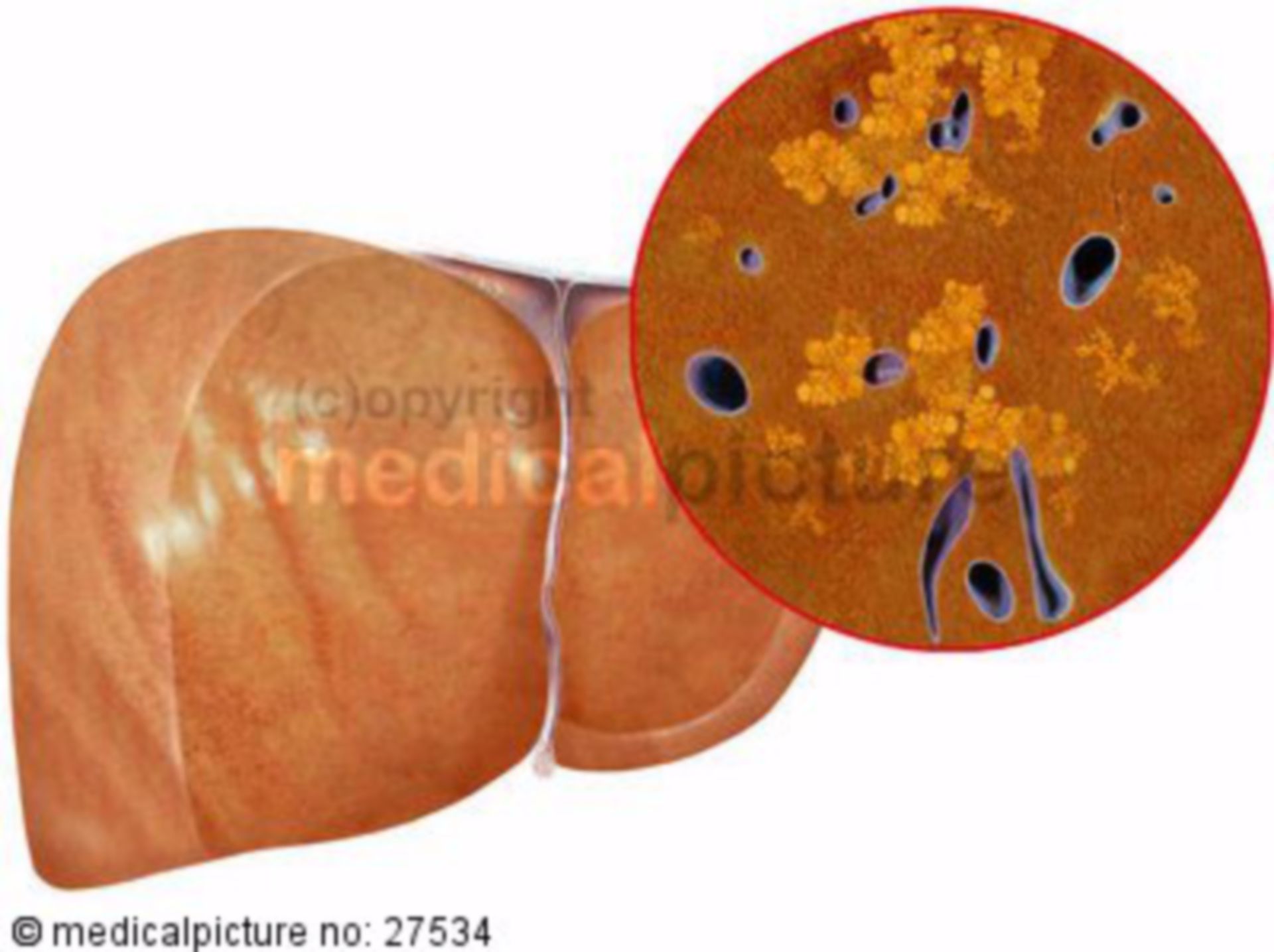 Fatty liver, organ and histology