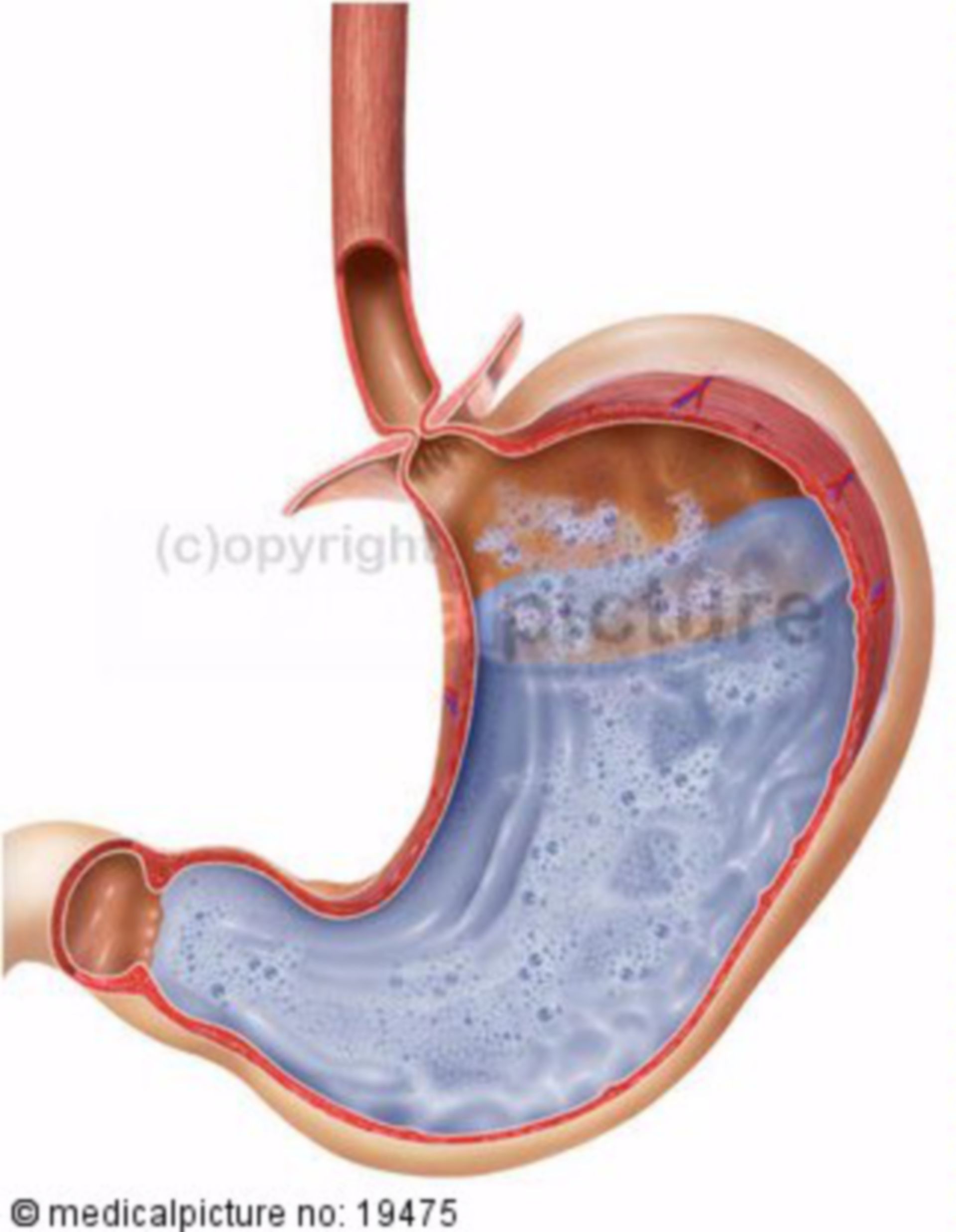 Stomach with Gastric Juice