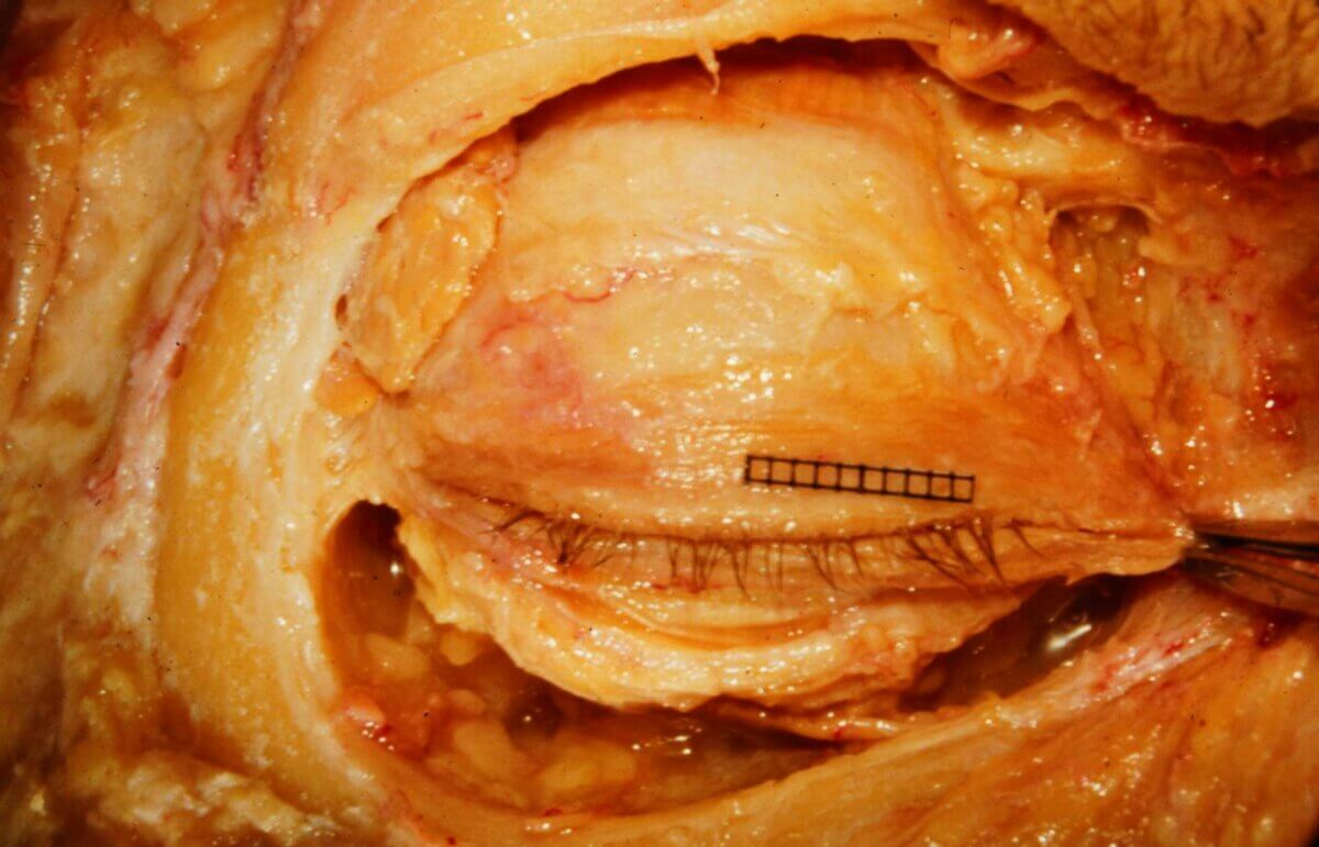 Präparat Auge