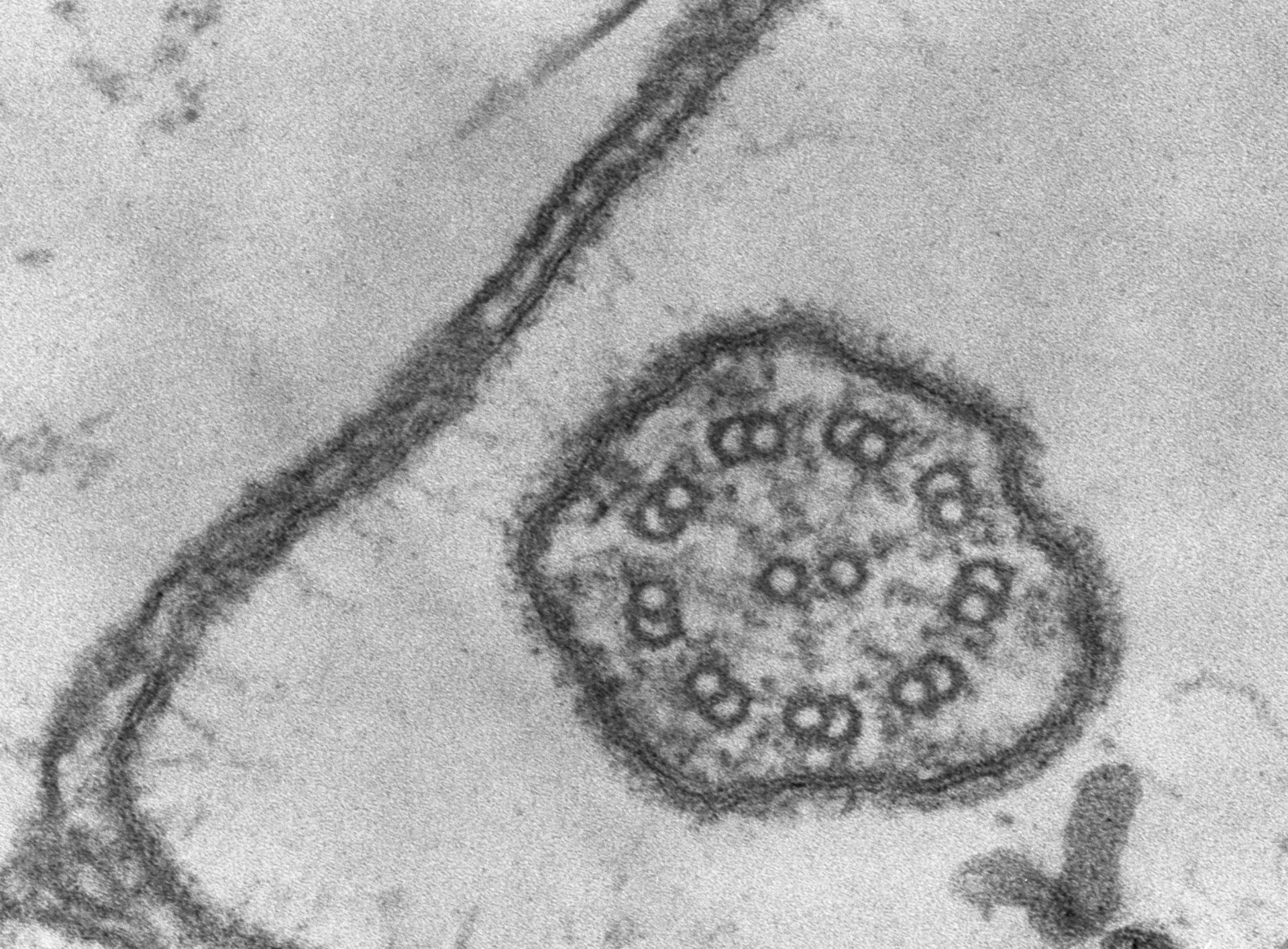 Coleps hirtus (Glycocalyx) - CIL:2871