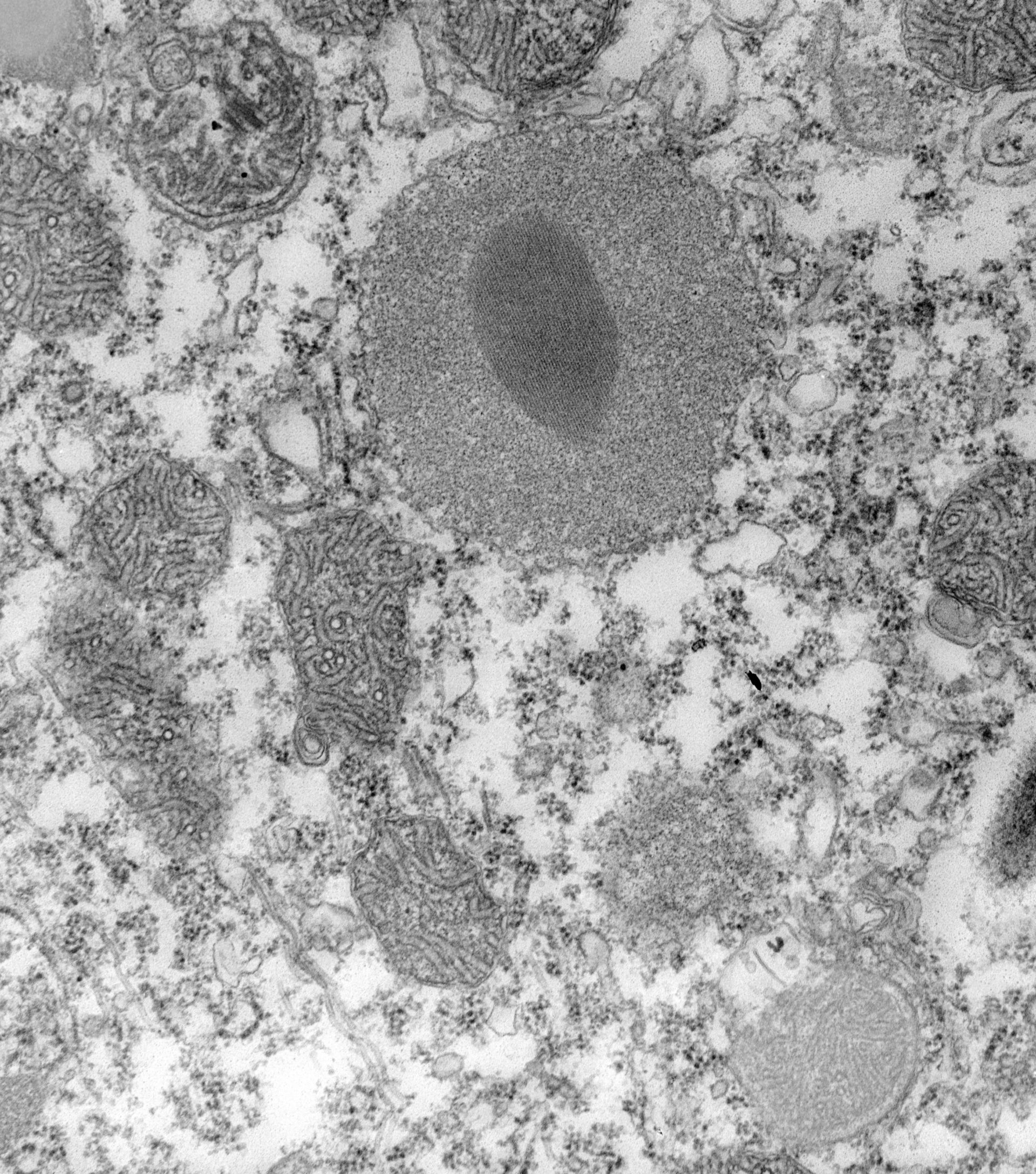 Paramecium caudatum (Autophagic vacuole) - CIL:39155