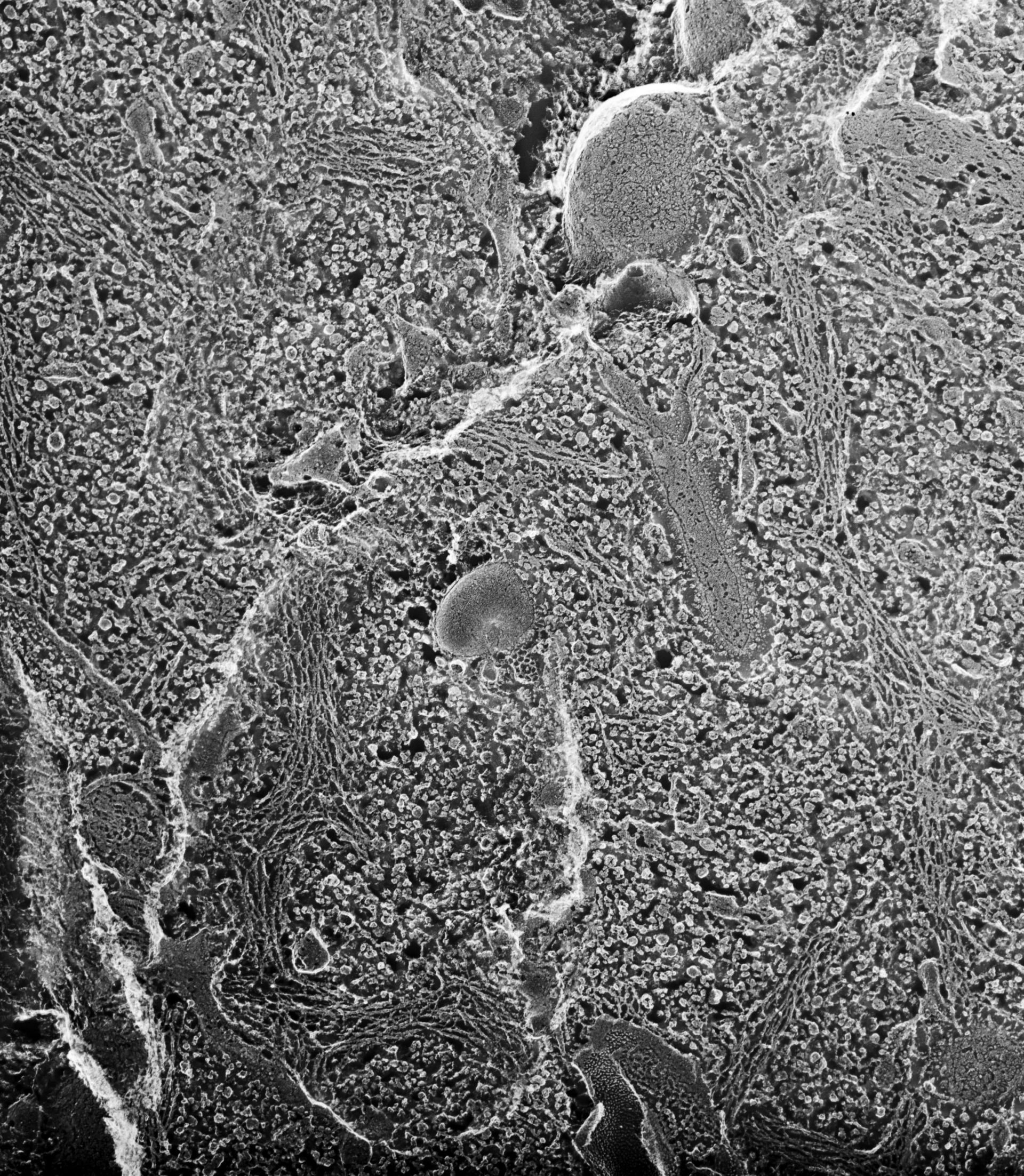 Paramecium multimicronucleatum (Early endosome) - CIL:12638