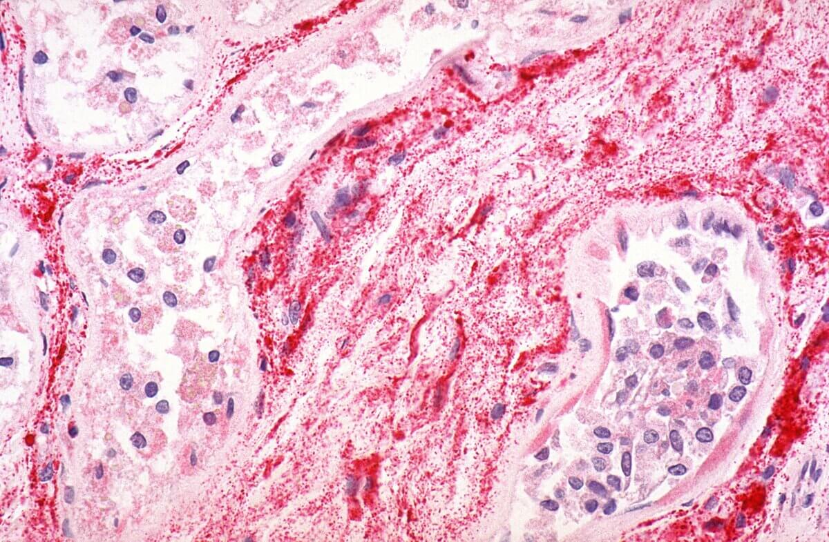 Immunhistochemie – Ebolavirus