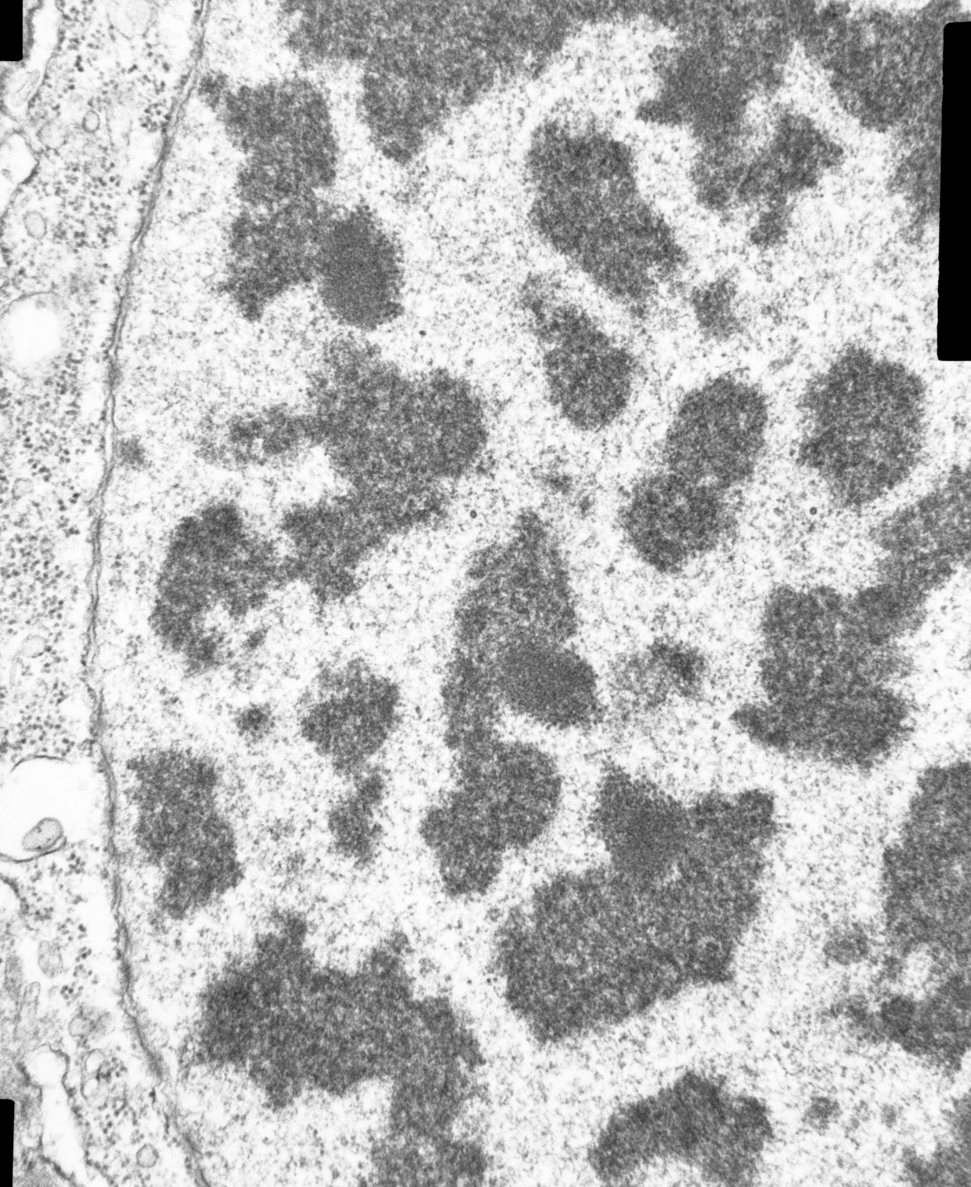 Opercularia coarctata (Nuclear envelope) - CIL:7338