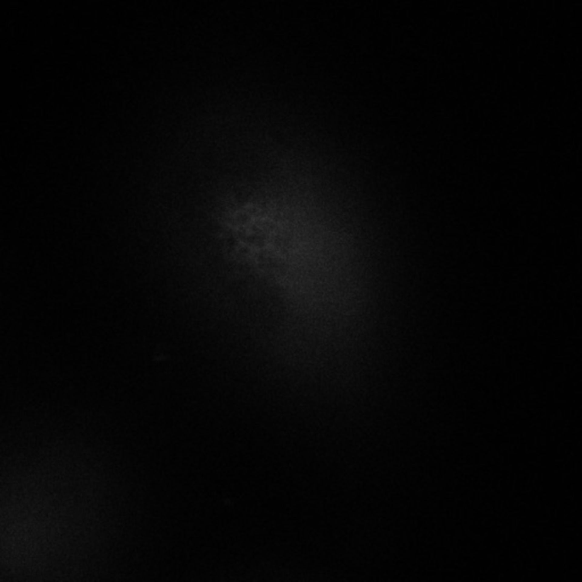 Homo sapiens (Endoplasmic reticulum) - CIL:9165